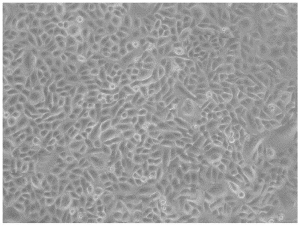 Cell culture medium additive, cell culture medium and cell in-vitro amplification method