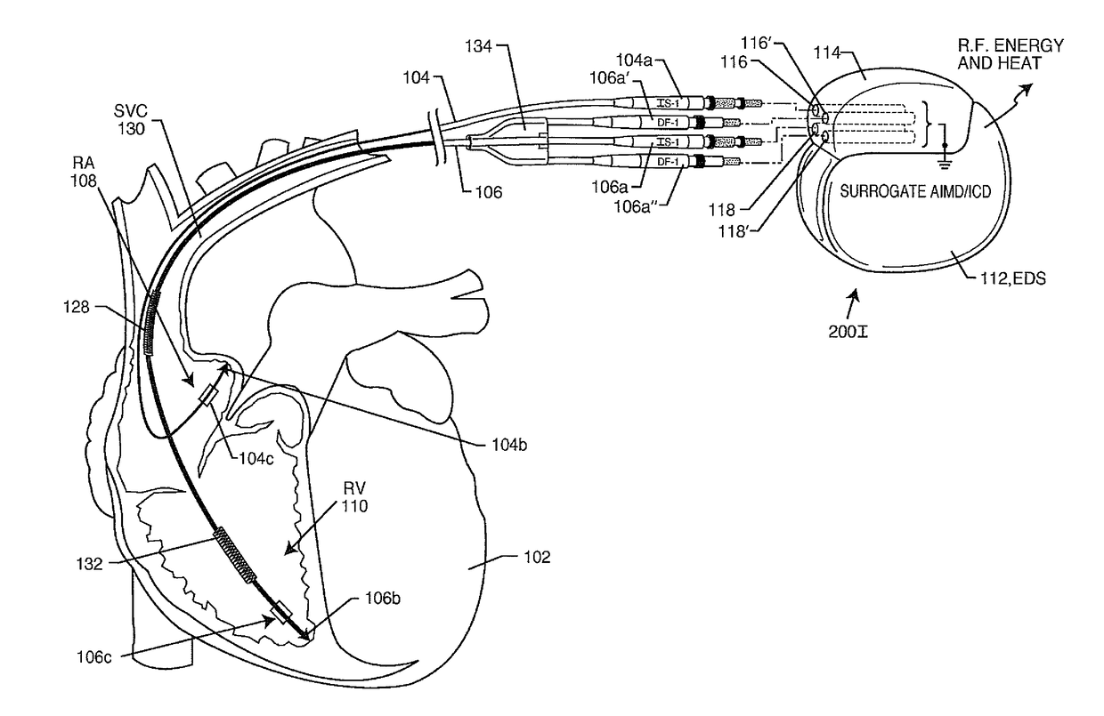 Surrogate implanted medical device for energy dissipation of existing implanted leads during MRI scans