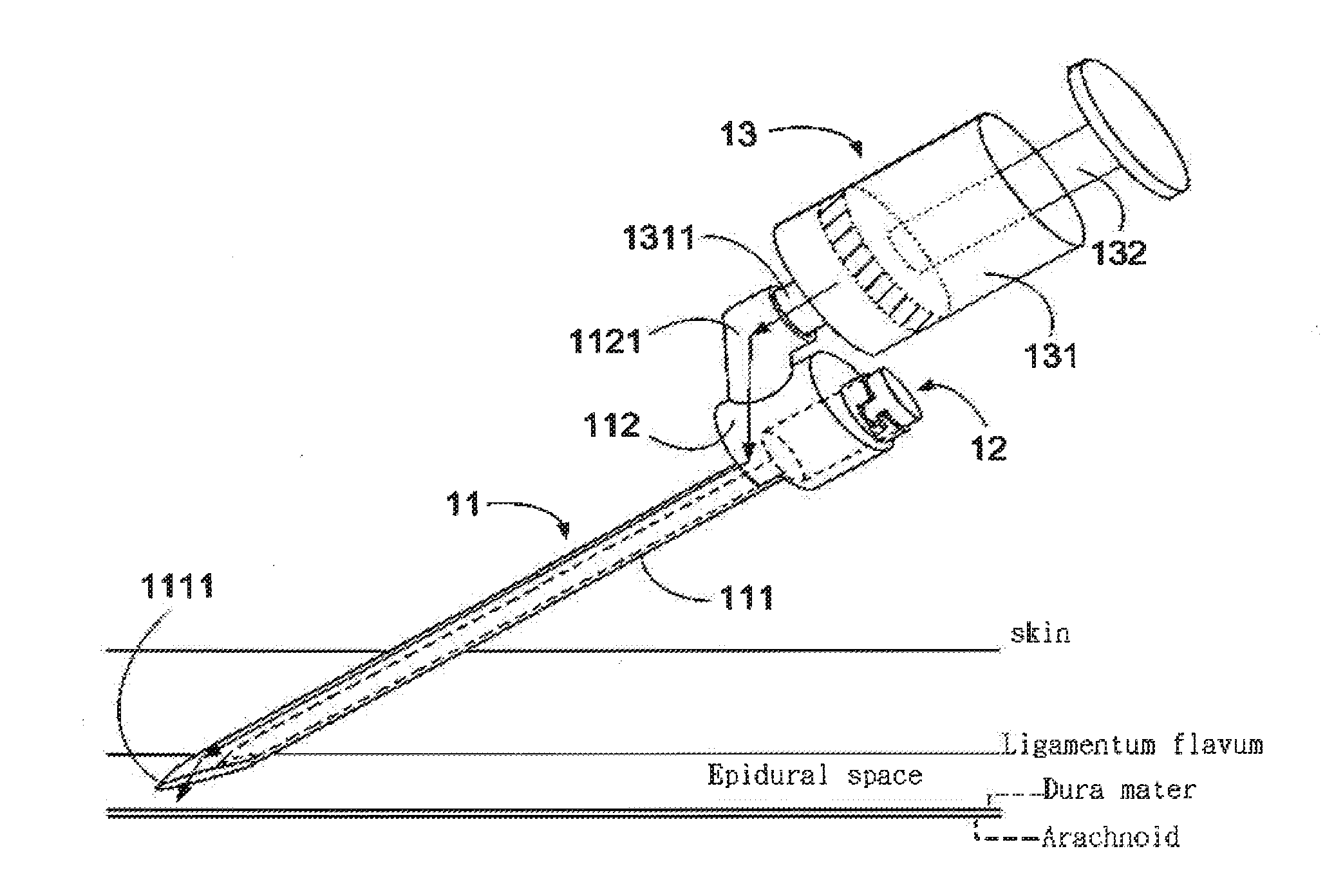 Ultrasonic positioning device for epidural space and method using the same