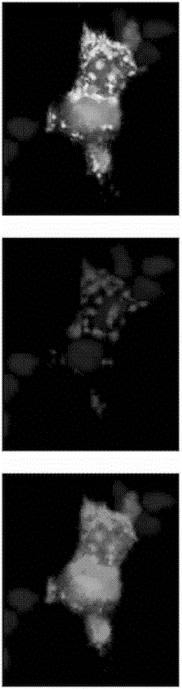 Monoclonal antibody against claudin-18 for the treatment of cancer