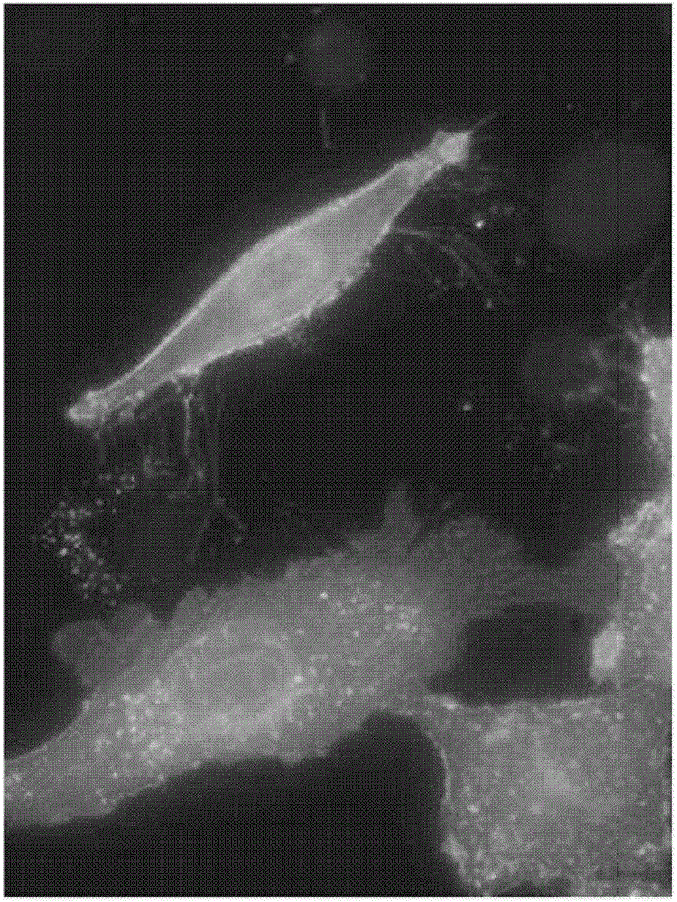 Monoclonal antibody against claudin-18 for the treatment of cancer