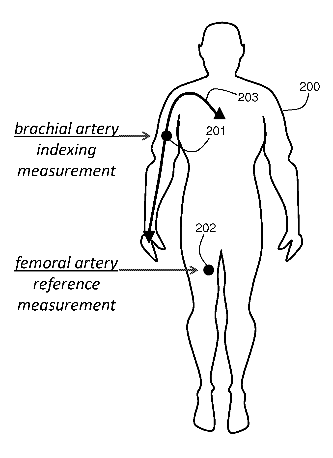 BODY-WORN SYSTEM FOR MEASURING CONTINUOUS NON-INVASIVE BLOOD PRESSURE (cNIBP)