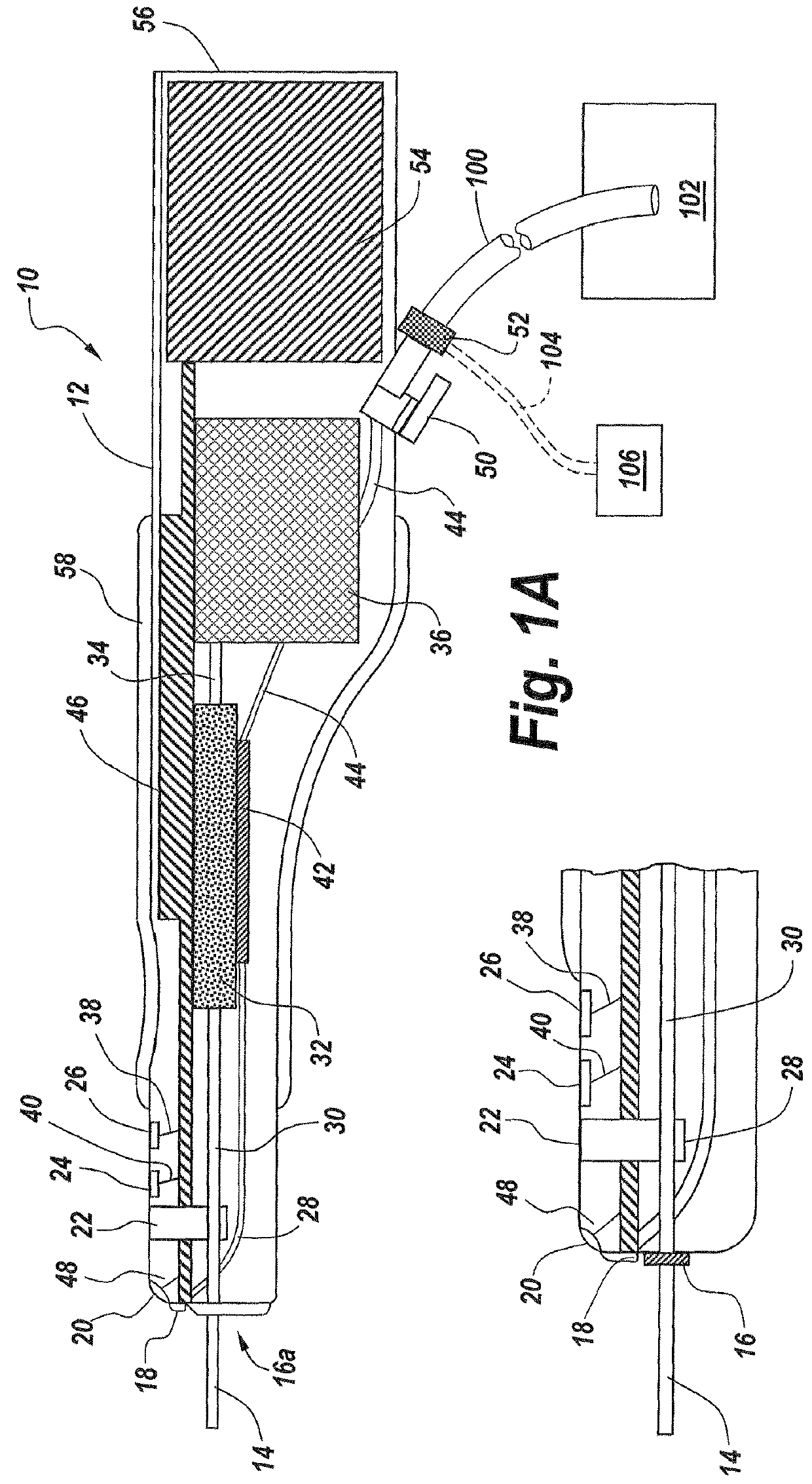 Ultrasonic descaling device