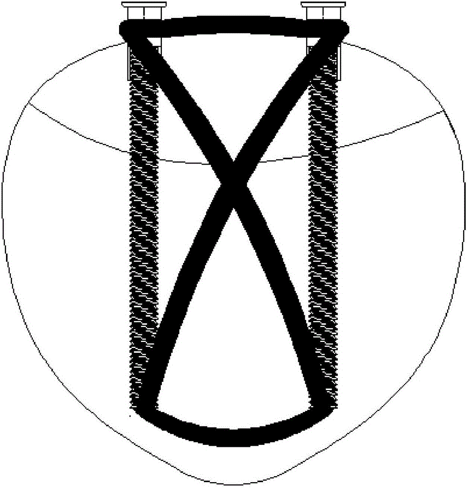 Patella locking, pressurizing and internally-fixing device