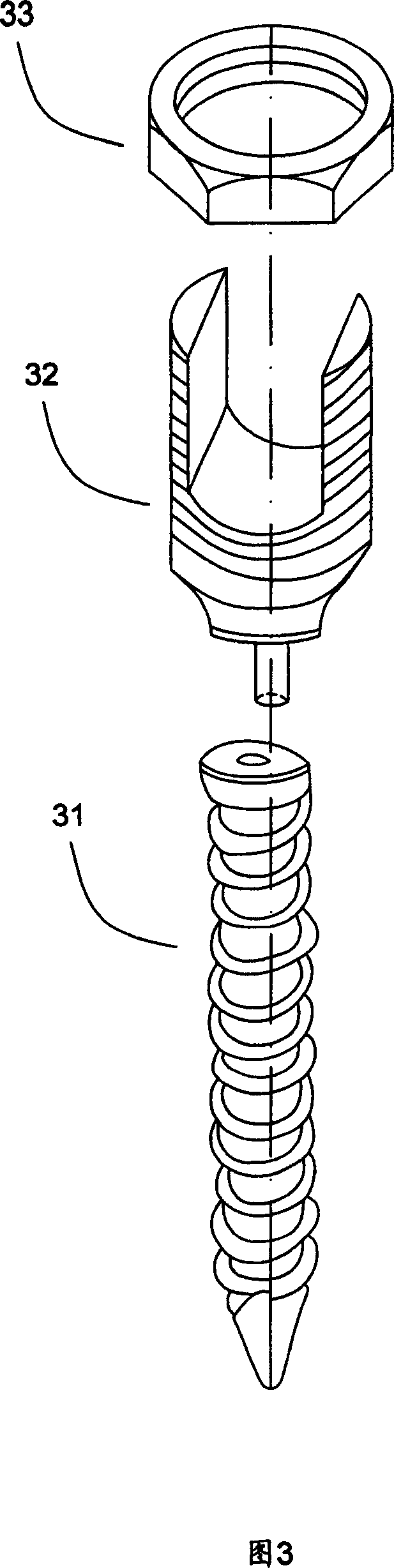 Non-blending spinal side bending corrector