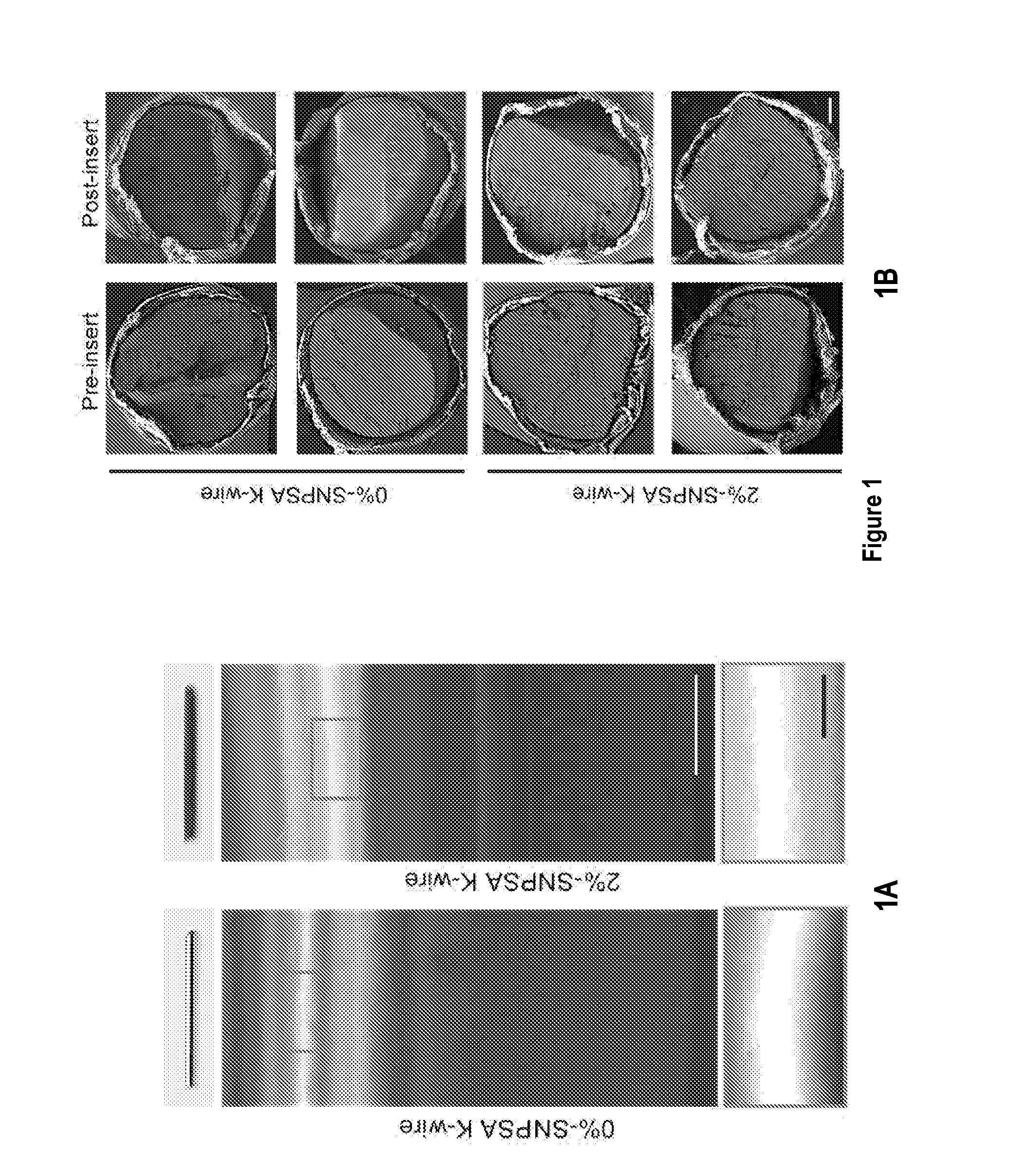 Nanoparticle-based scaffolds and implants, methods for making the same, and applications thereof