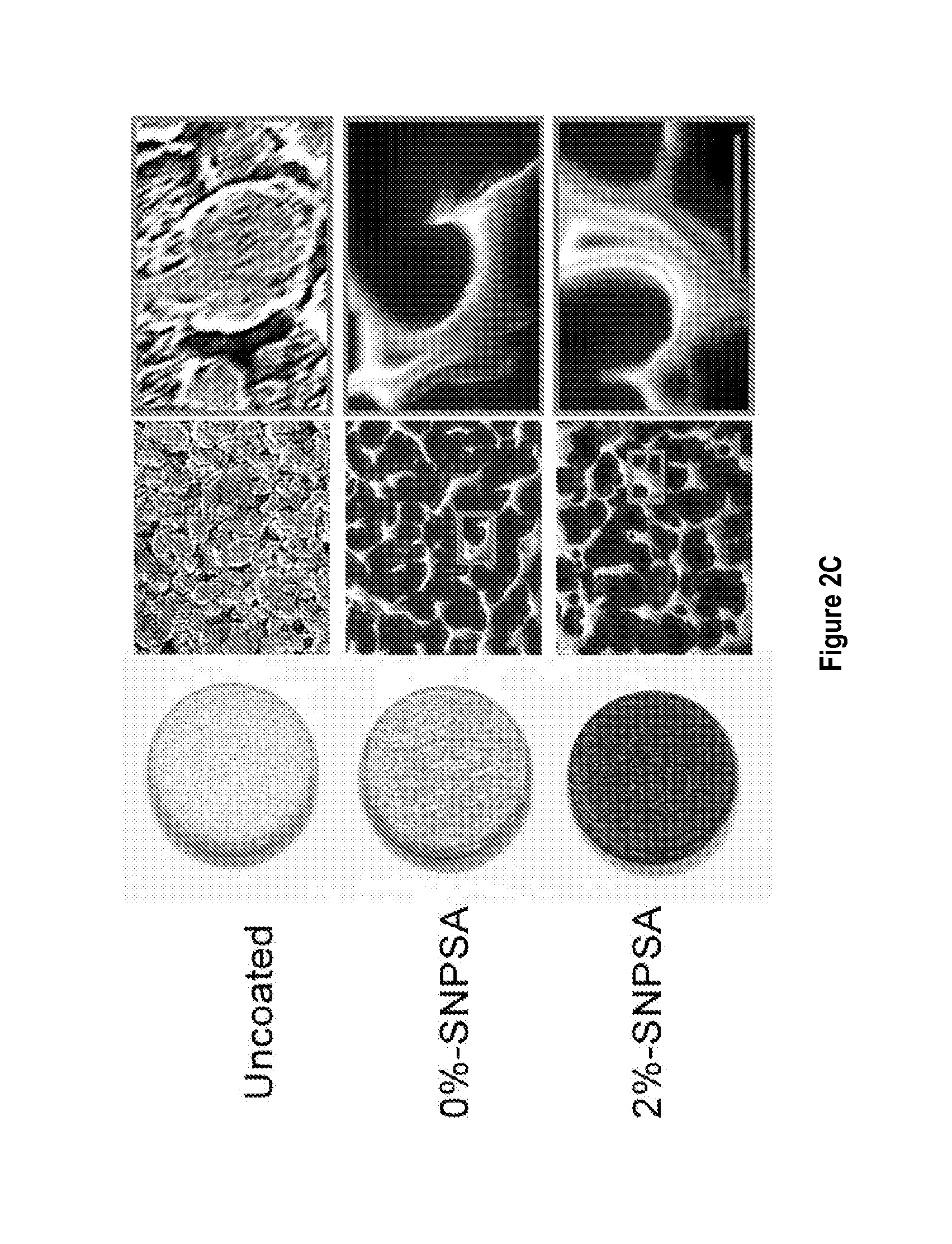 Nanoparticle-based scaffolds and implants, methods for making the same, and applications thereof