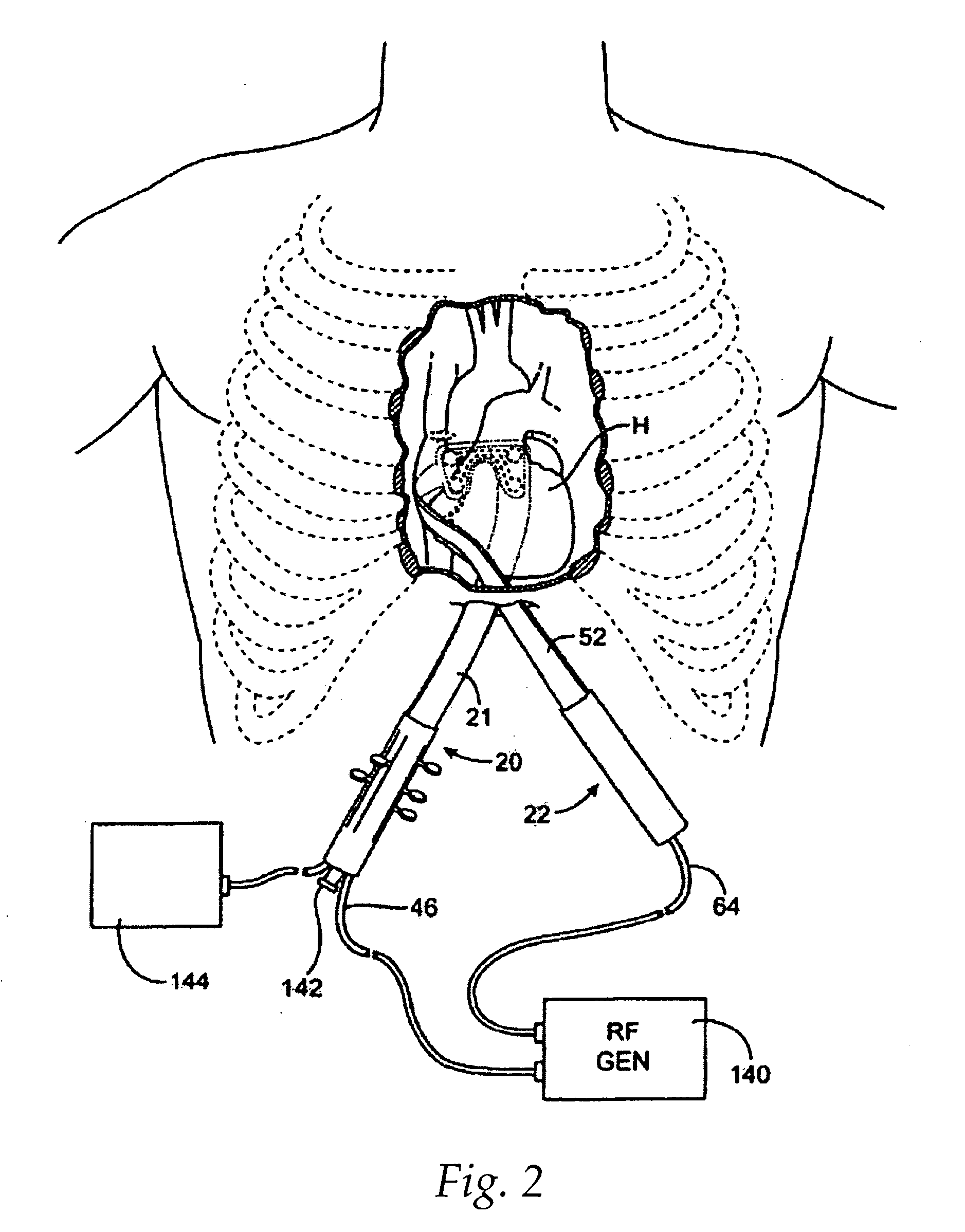 Switching methods and apparatus