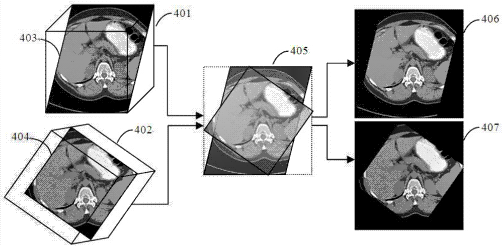 Medical image analysis method, system and medical device