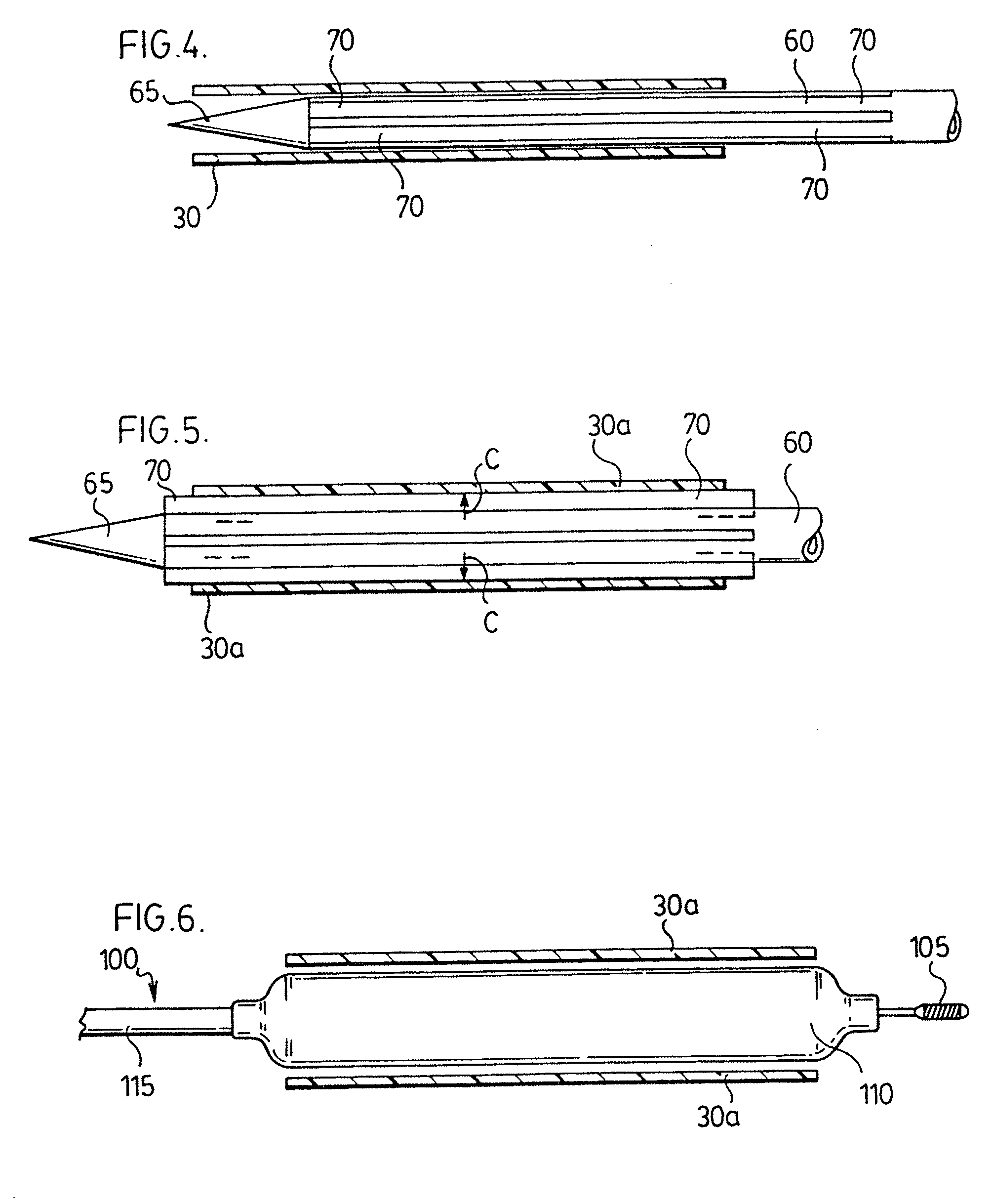Small vessel expandable stent and method for production of same