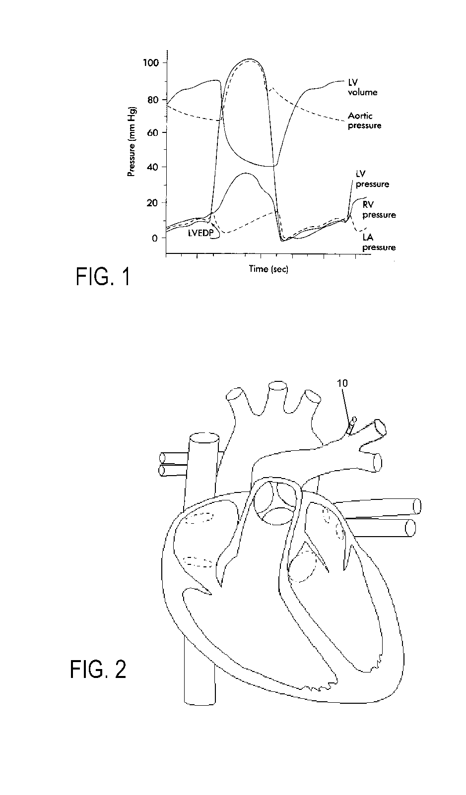 Delivery method and system for monitoring cardiovascular pressures