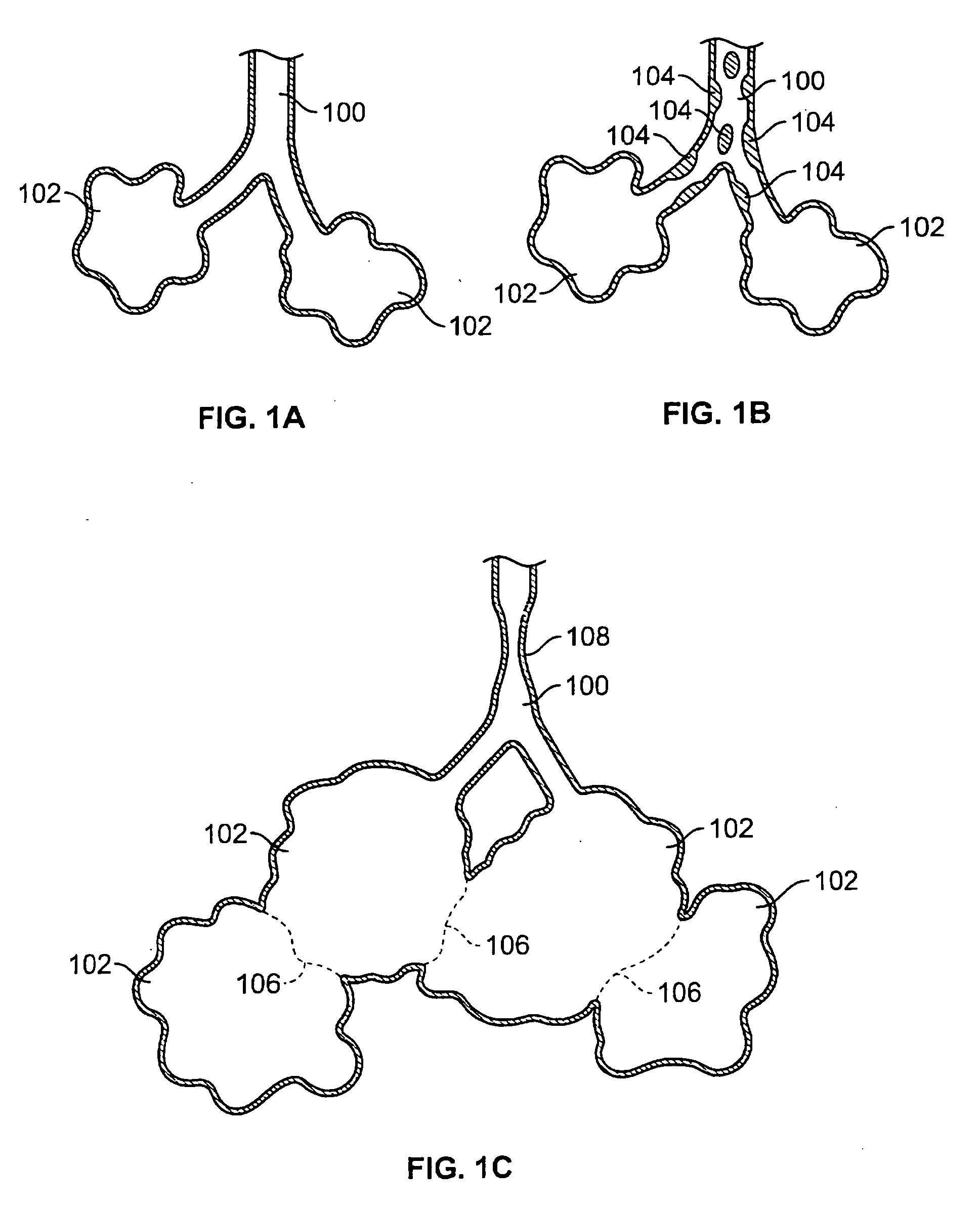 Devices for maintaining patency of surgically created channels in tissue