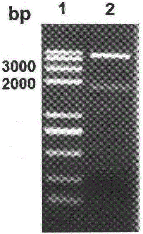 Helicobacter pylori multivalent epitope vaccine and preparation method thereof