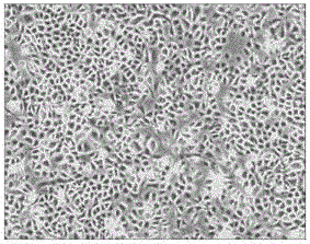 Human skin epidermal cell culture medium and application thereof