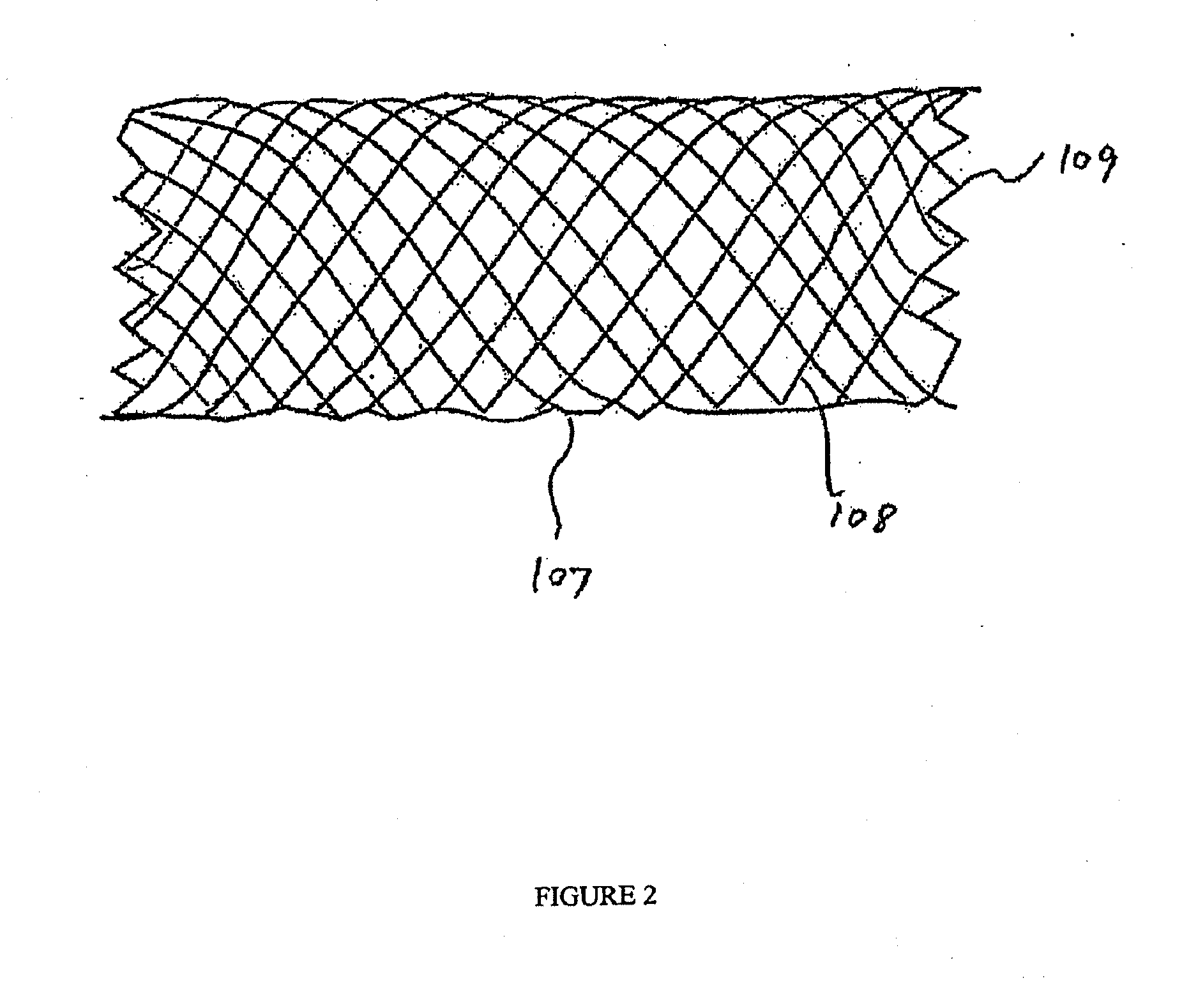 Endovascular device