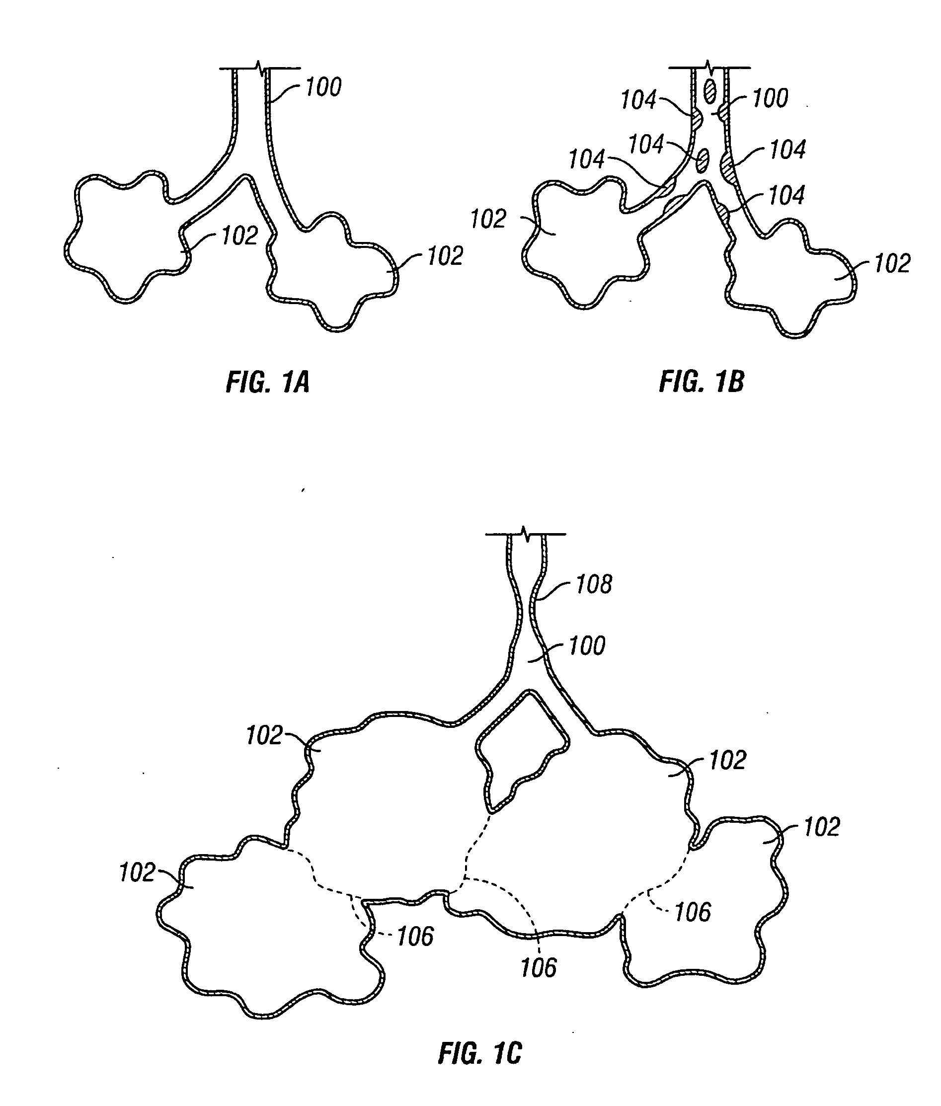 Devices for maintaining surgically created openings