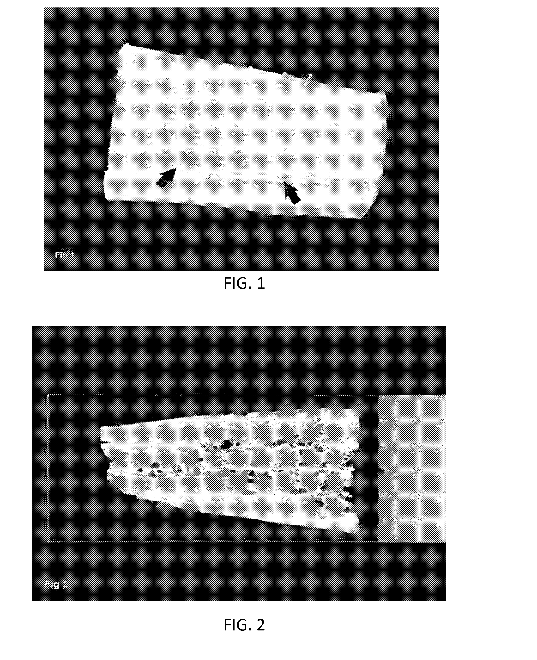 Composition and method of preparation of bone allograft from endosteal portion of bone and isolated bone periosteum