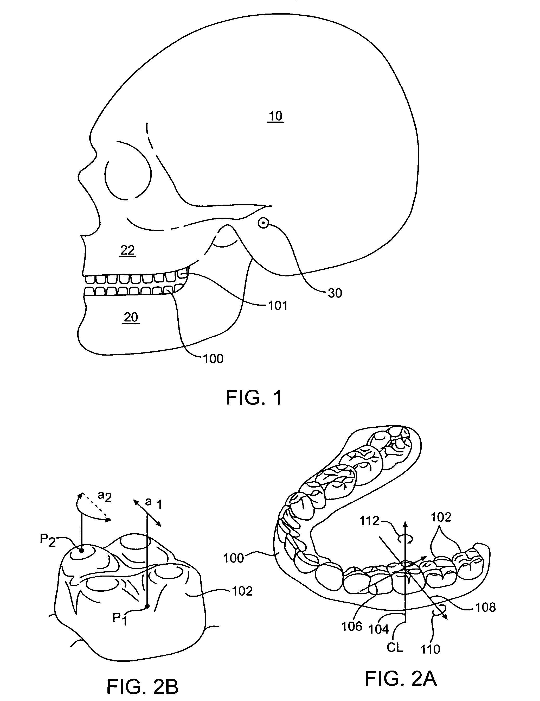 System and method for positioning teeth