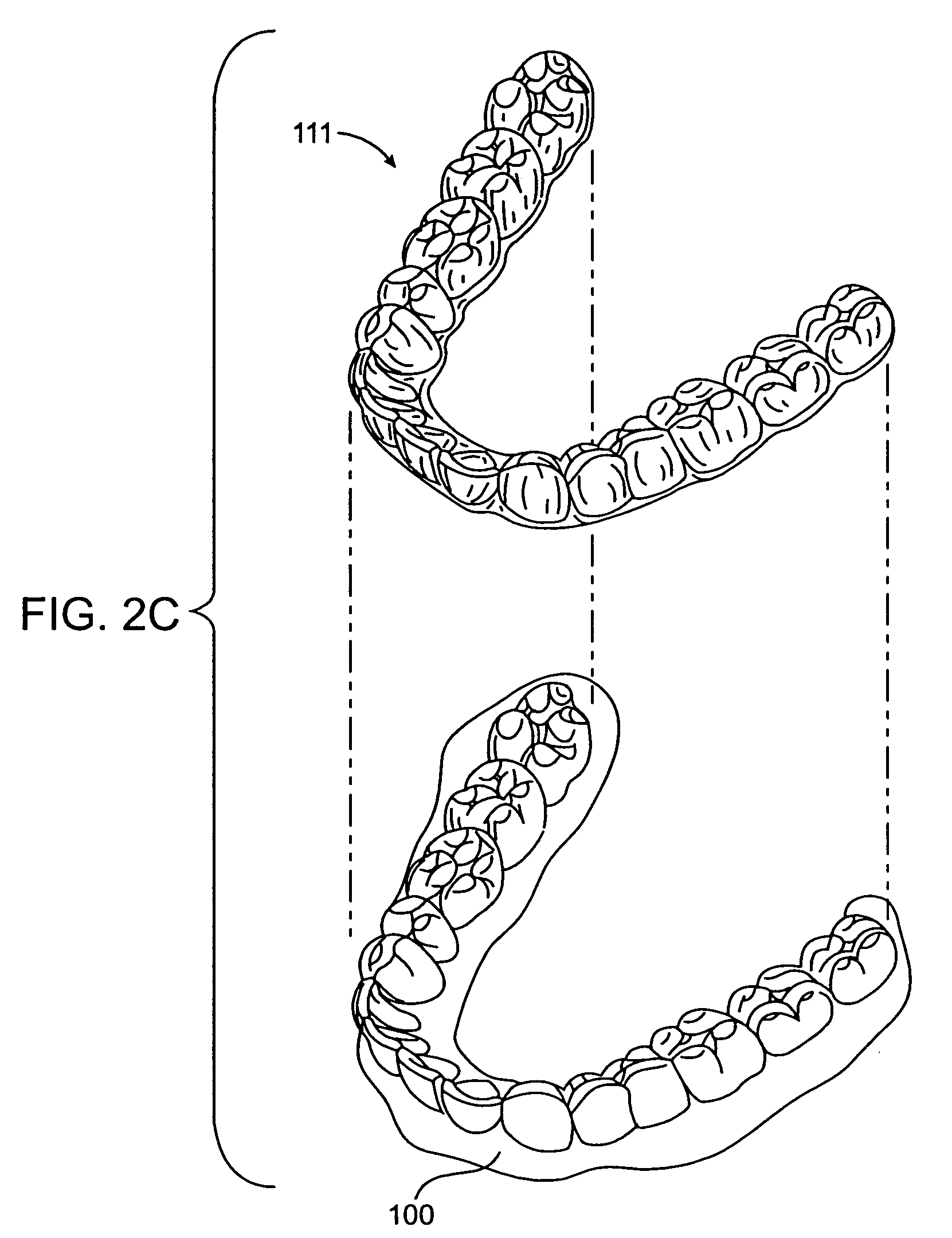 System and method for positioning teeth