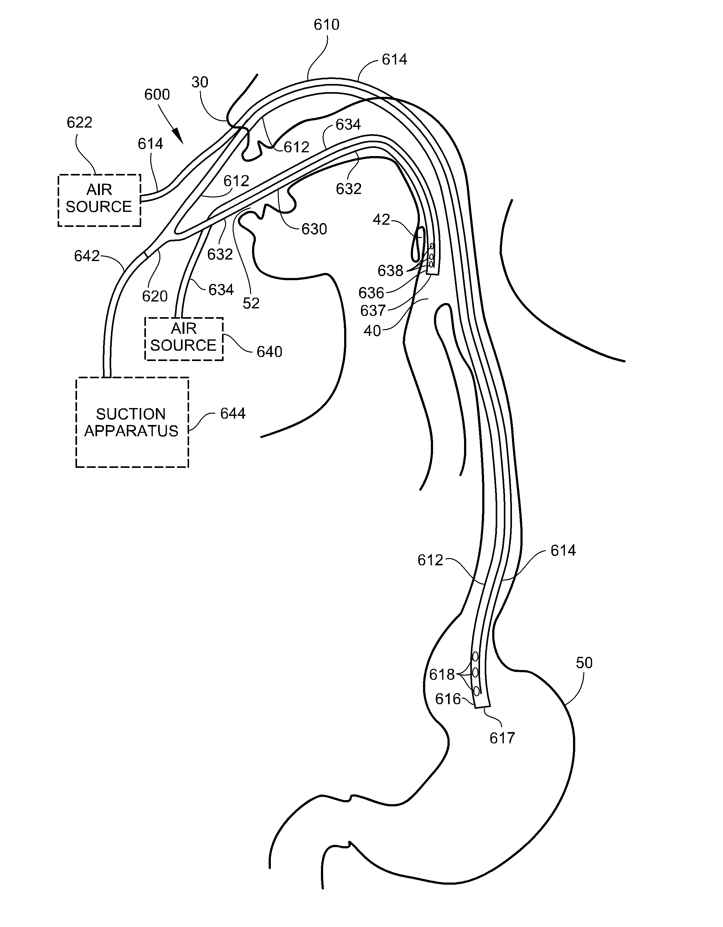 Medical Apparatus With Hypopharyngeal Suctioning Capability