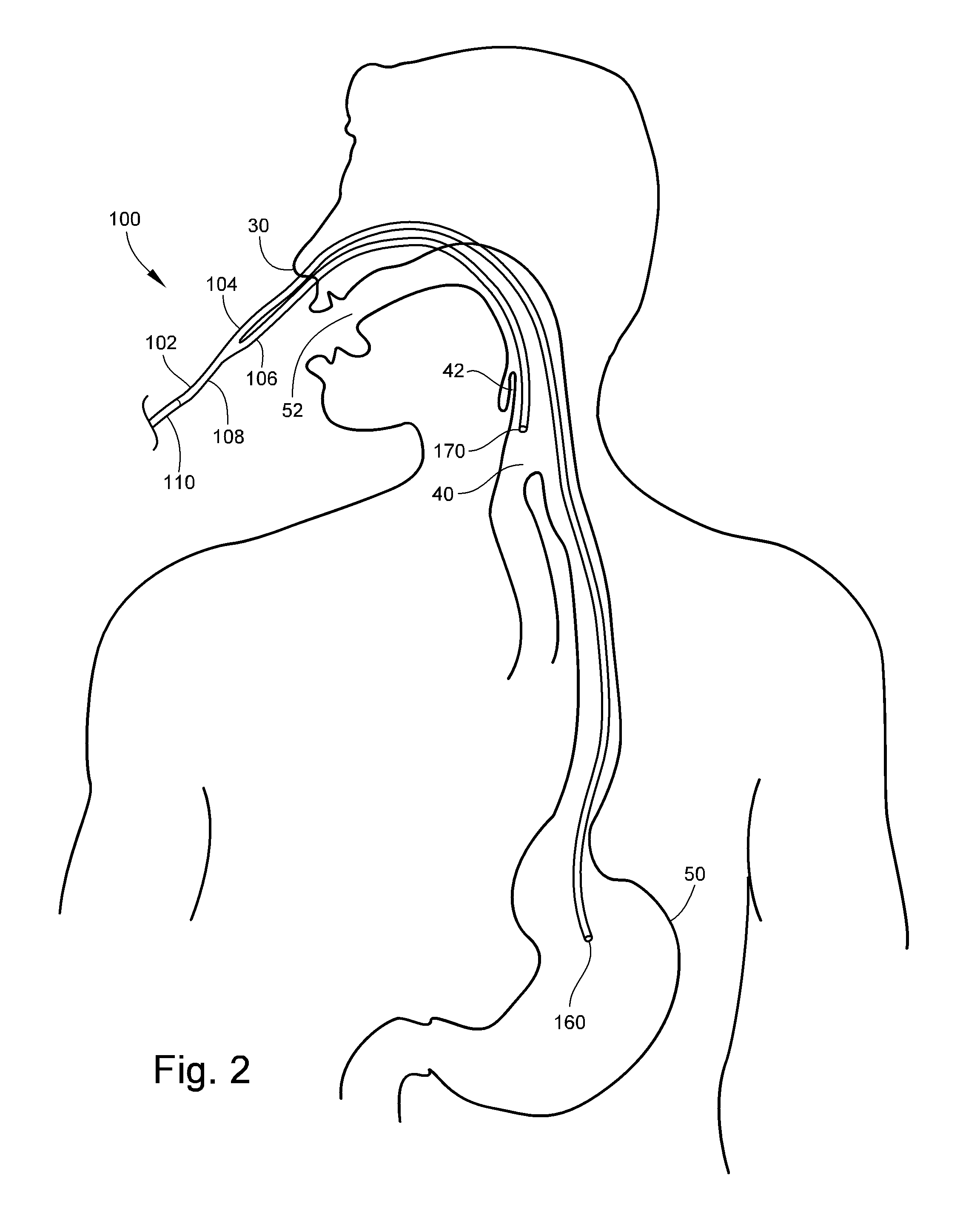 Medical Apparatus With Hypopharyngeal Suctioning Capability