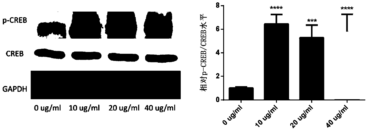 Application of dendrobium officinale polysaccharide in preparation of medicine for treating hypopigmentation skin disease