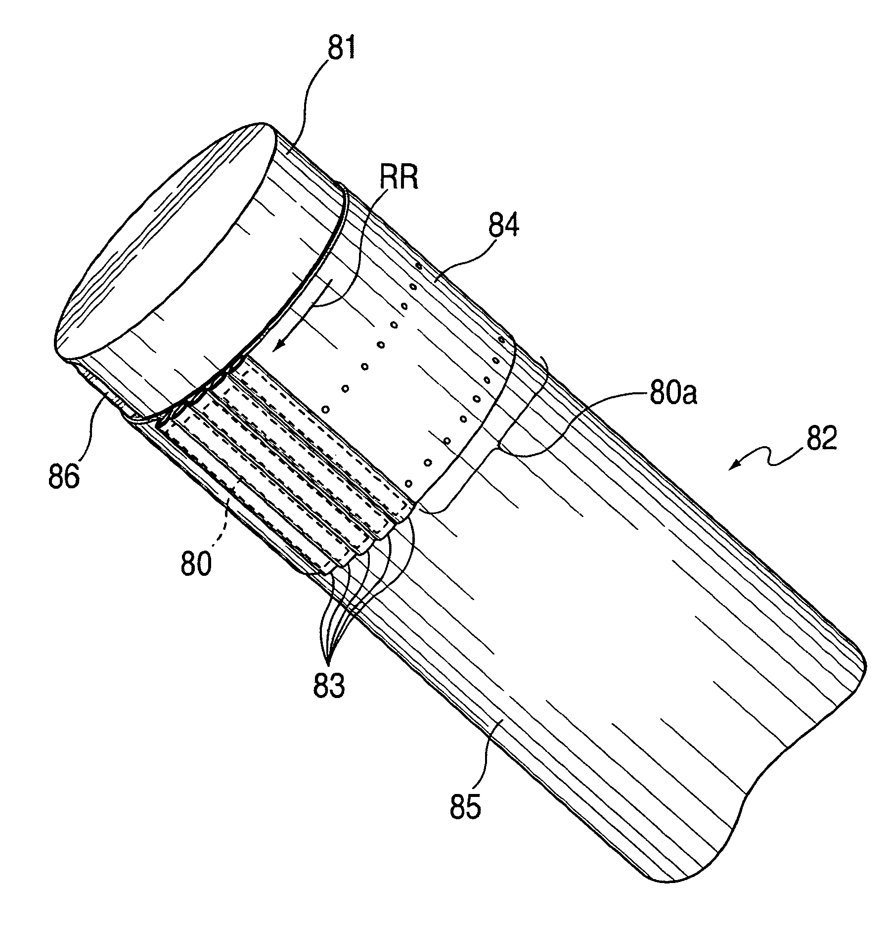 Device and method for tacking plaque to a blood vessel wall