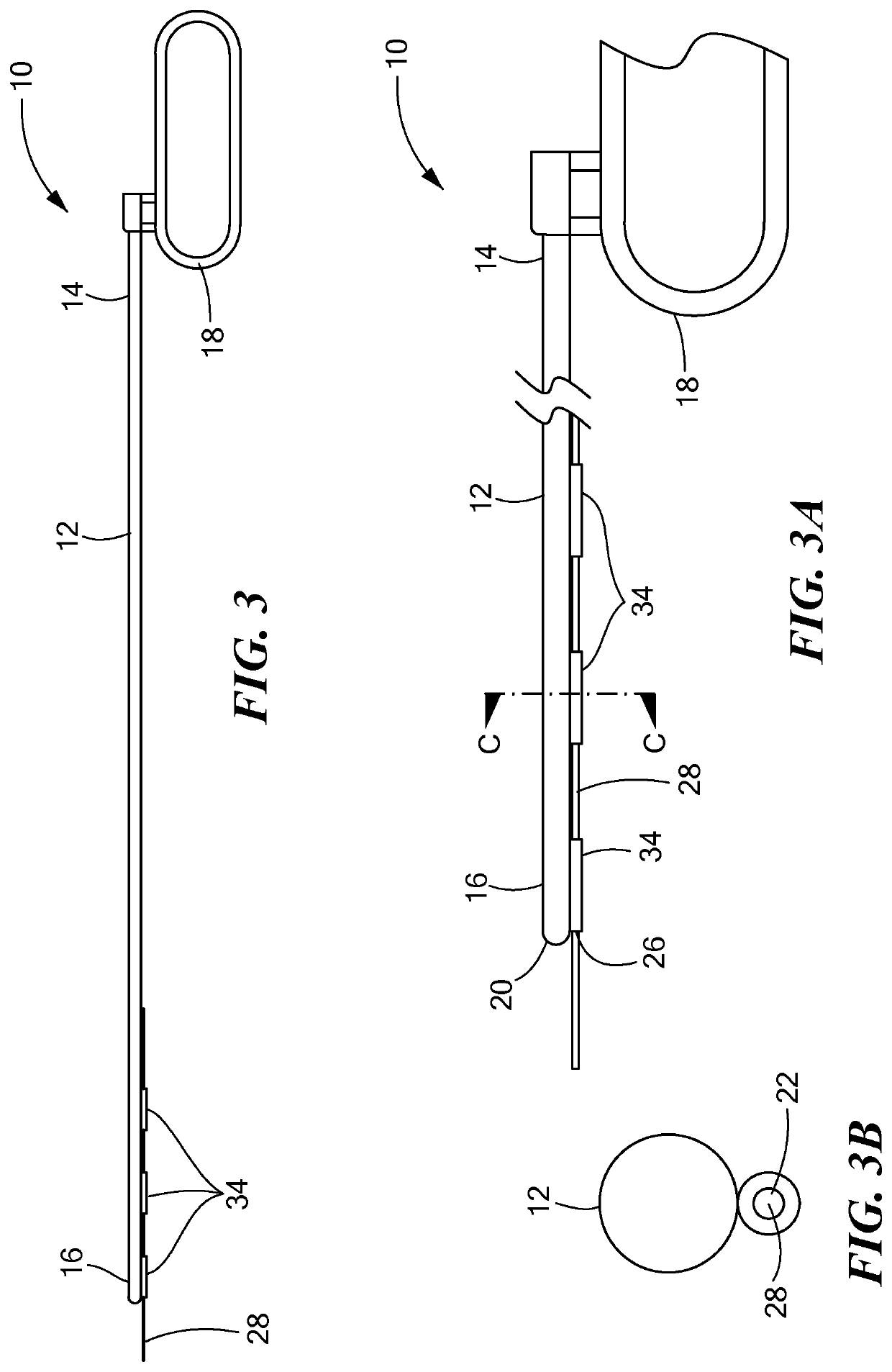 Over-the-wire delivery of a substernal lead