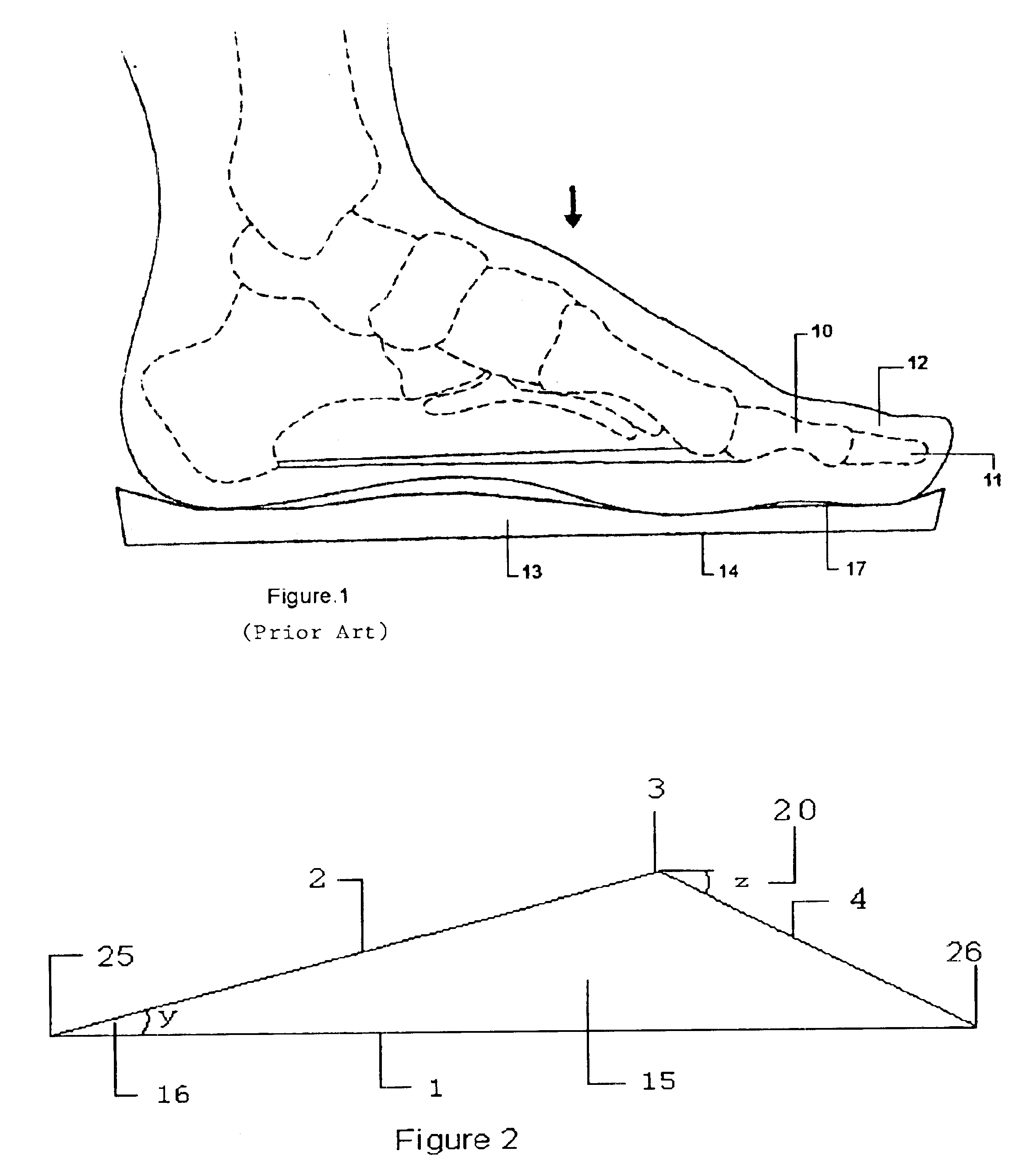 Orthopedic shoe appliance and method