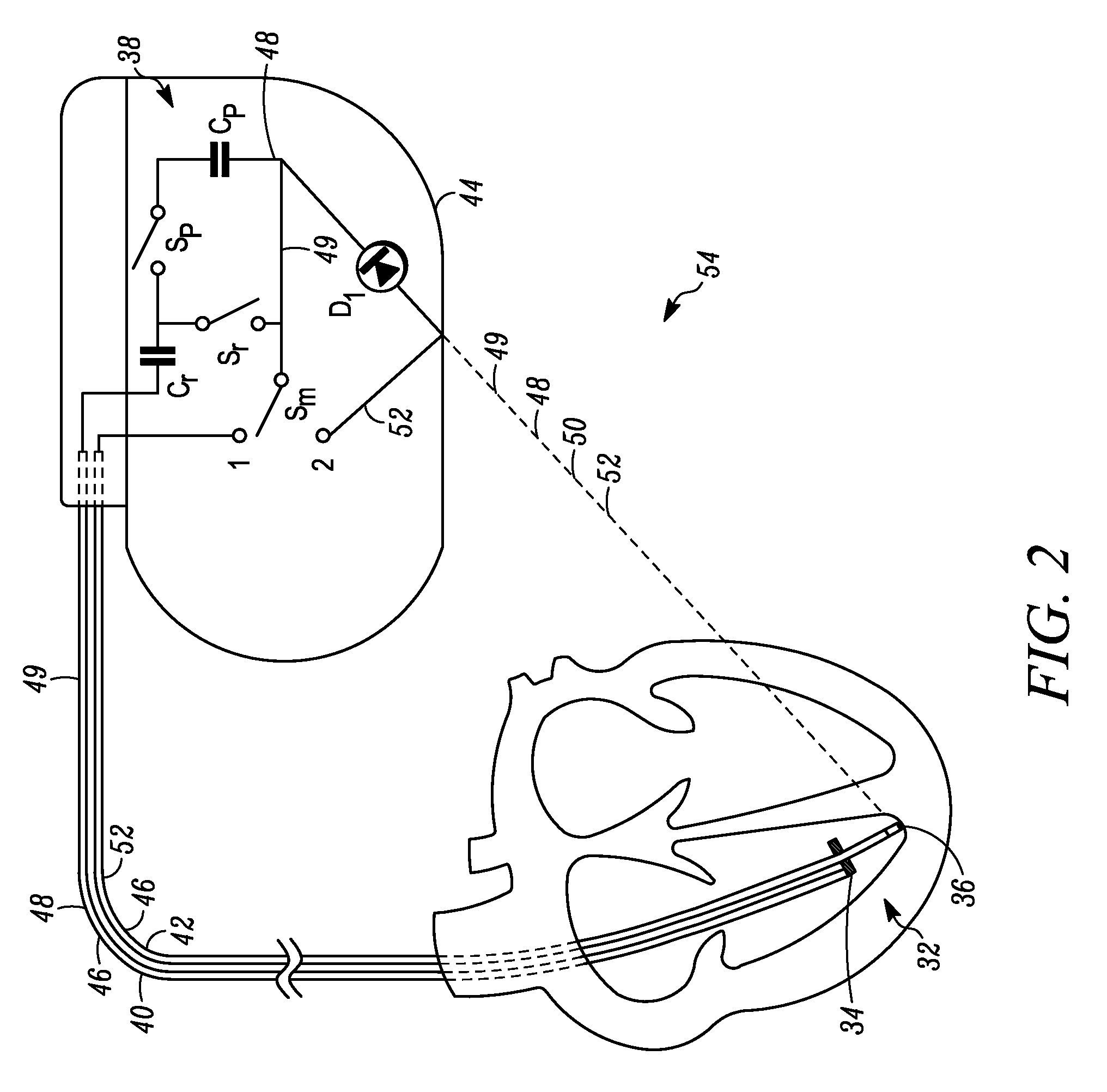 MRI Compatible Implantable Medical Devices and Methods