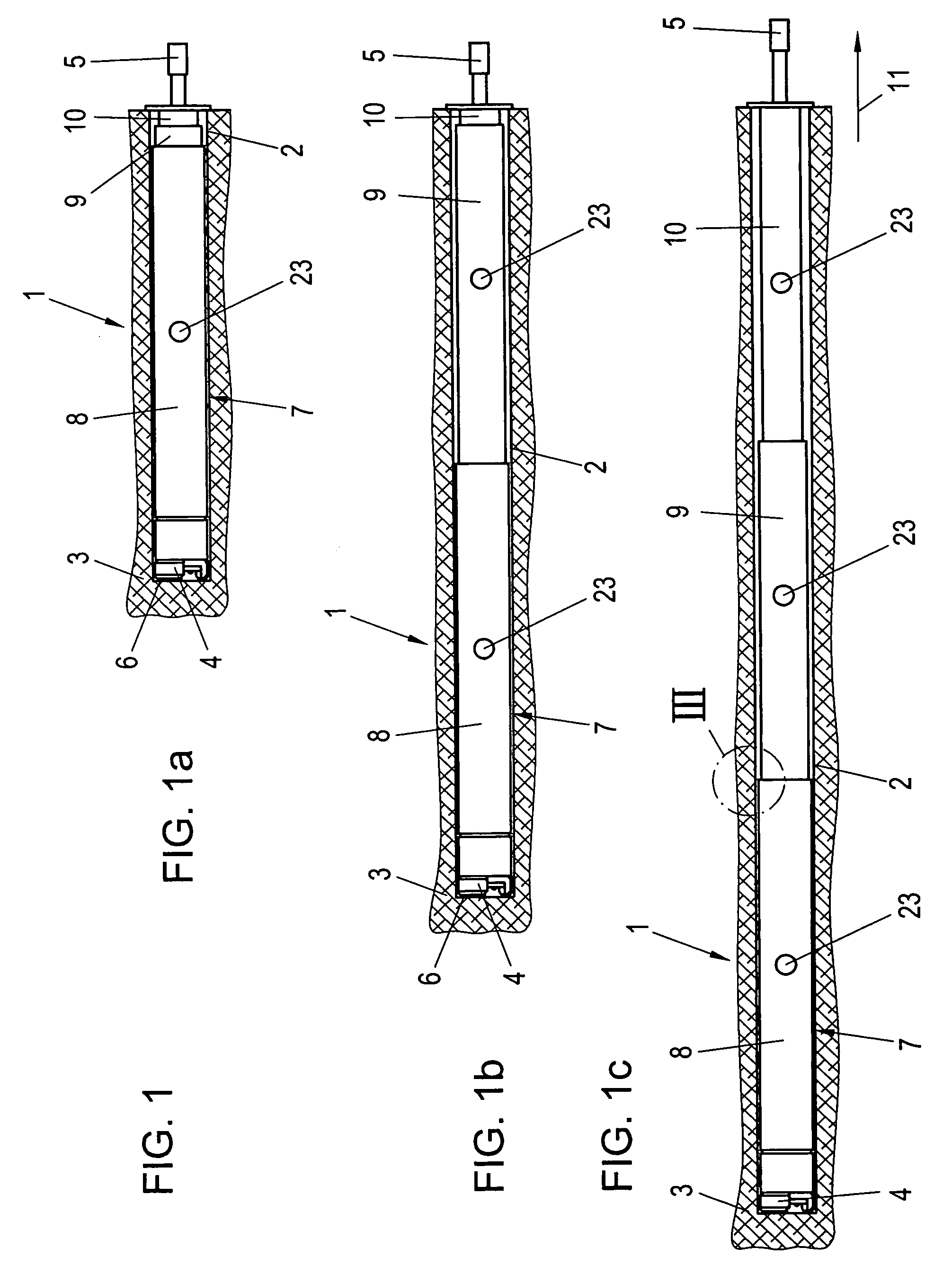 Method and device for producing pretensioned anchorings