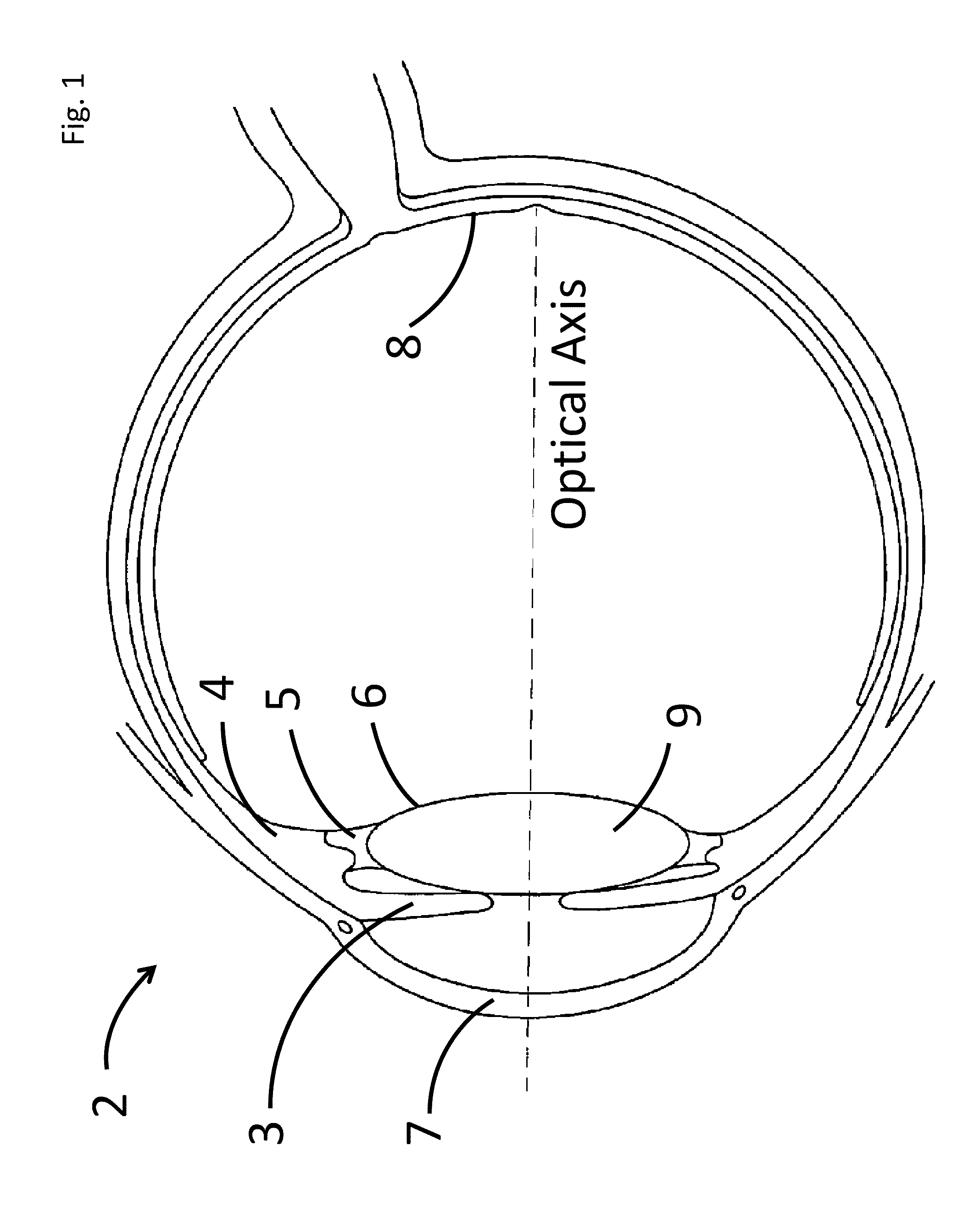 Fluidic intraocular lens systems and methods