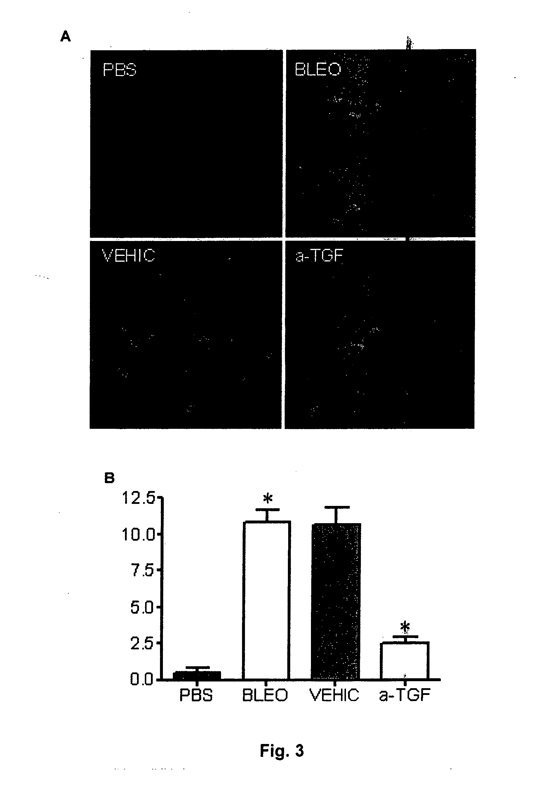 Method for the treatment of skin fibrosis and suitable compositions for such treatment