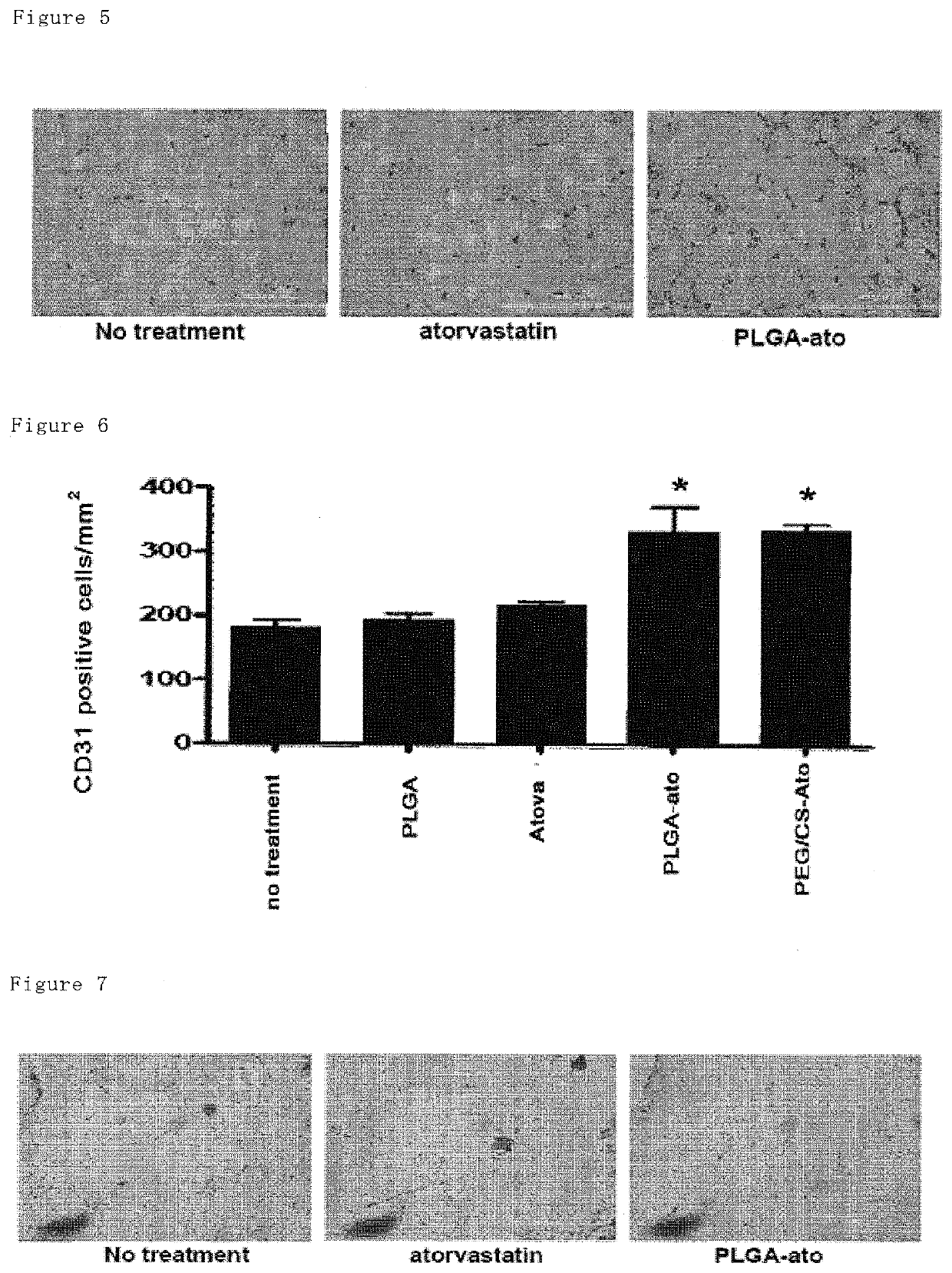 Pharmaceutical composition containing statin-encapsulated nanoparticle