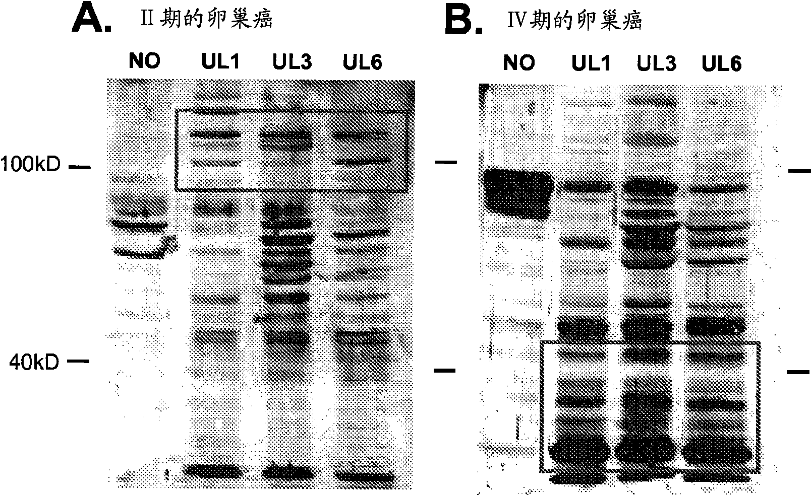 Methods of detecting autoantibodies for diagnosing and characterizing disorders
