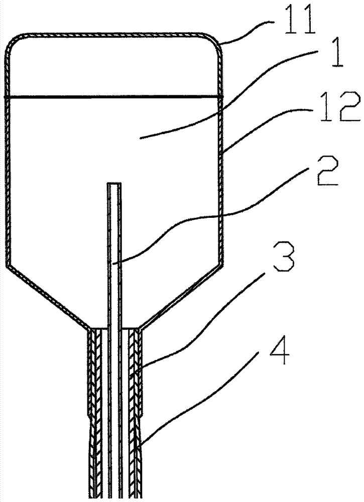 A Novel Tumor Cryoablation Catheter