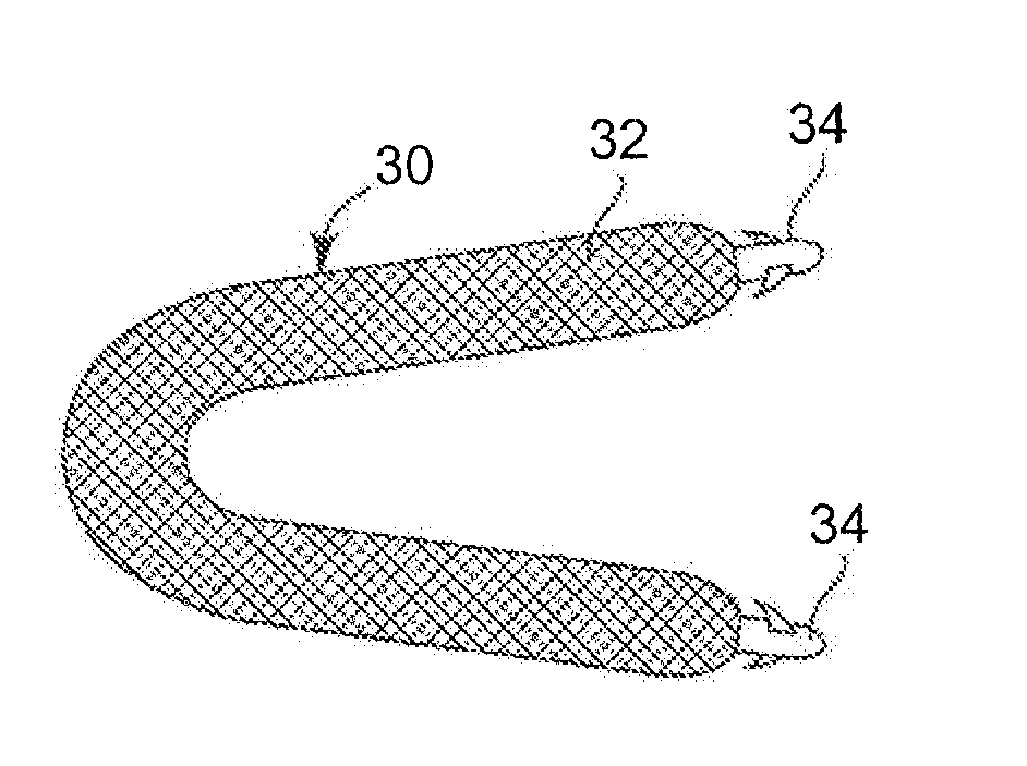 Minimally Invasive Implant and Method