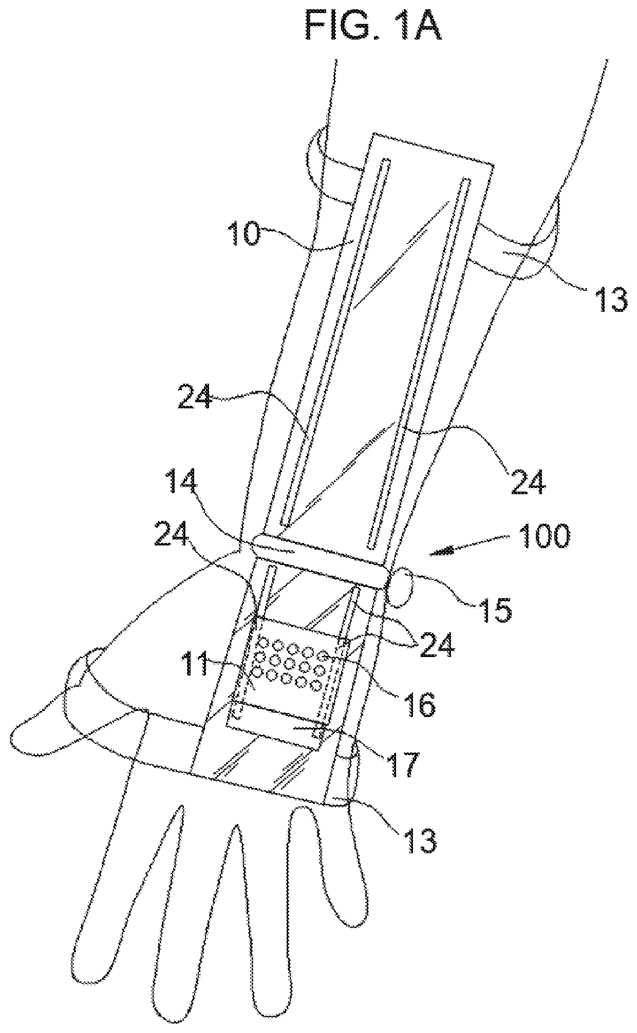Transilluminating Immobilizer for Intravenous and Intra-arterial procedures