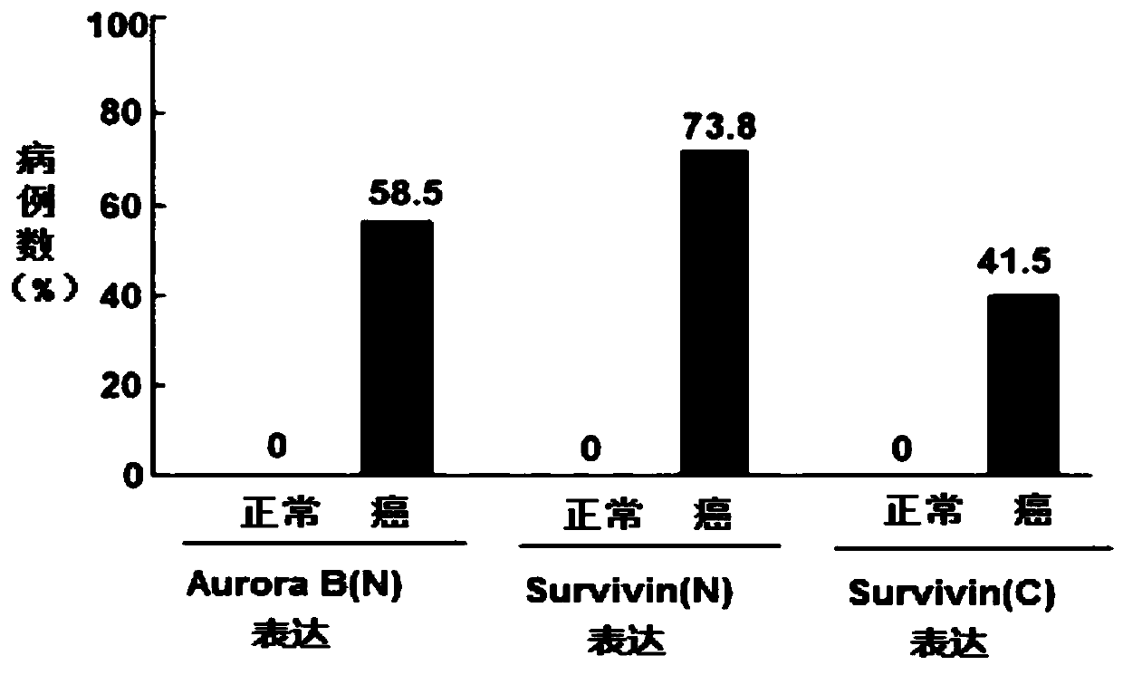 Application of Aurora-B kinase and Survivin in preparation of colorectal cancer diagnosis kit