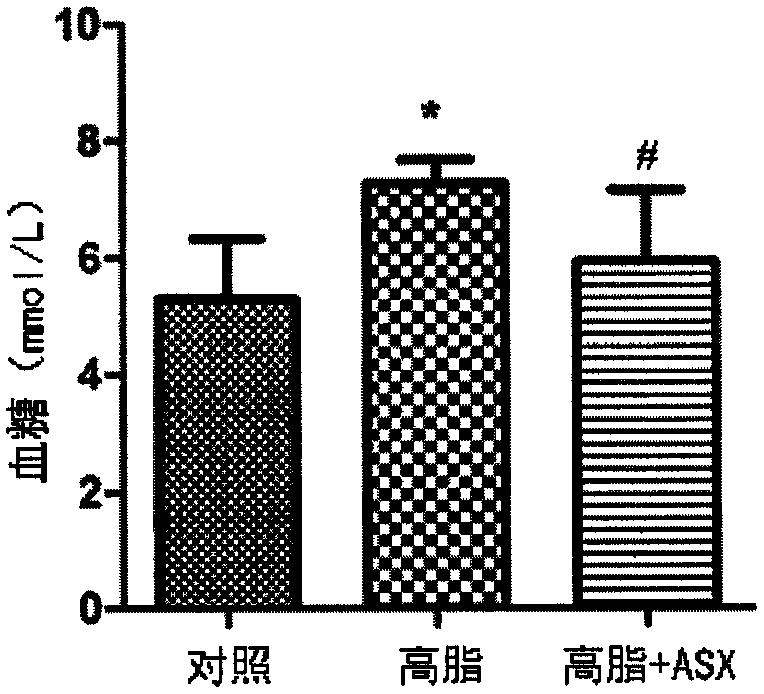 Application of astaxanthin in preparation of drugs for prevention and treatment of glomerular fibrosis and edema