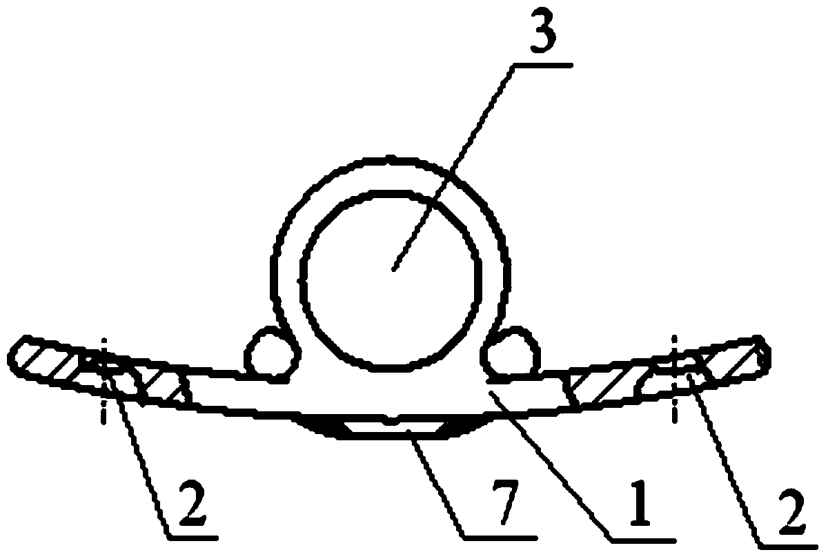 Bionic artificial atlanto-odontoid joint