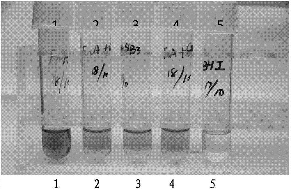 Streptococcus salivarius and application thereof in preparing ozostomia eliminating drug