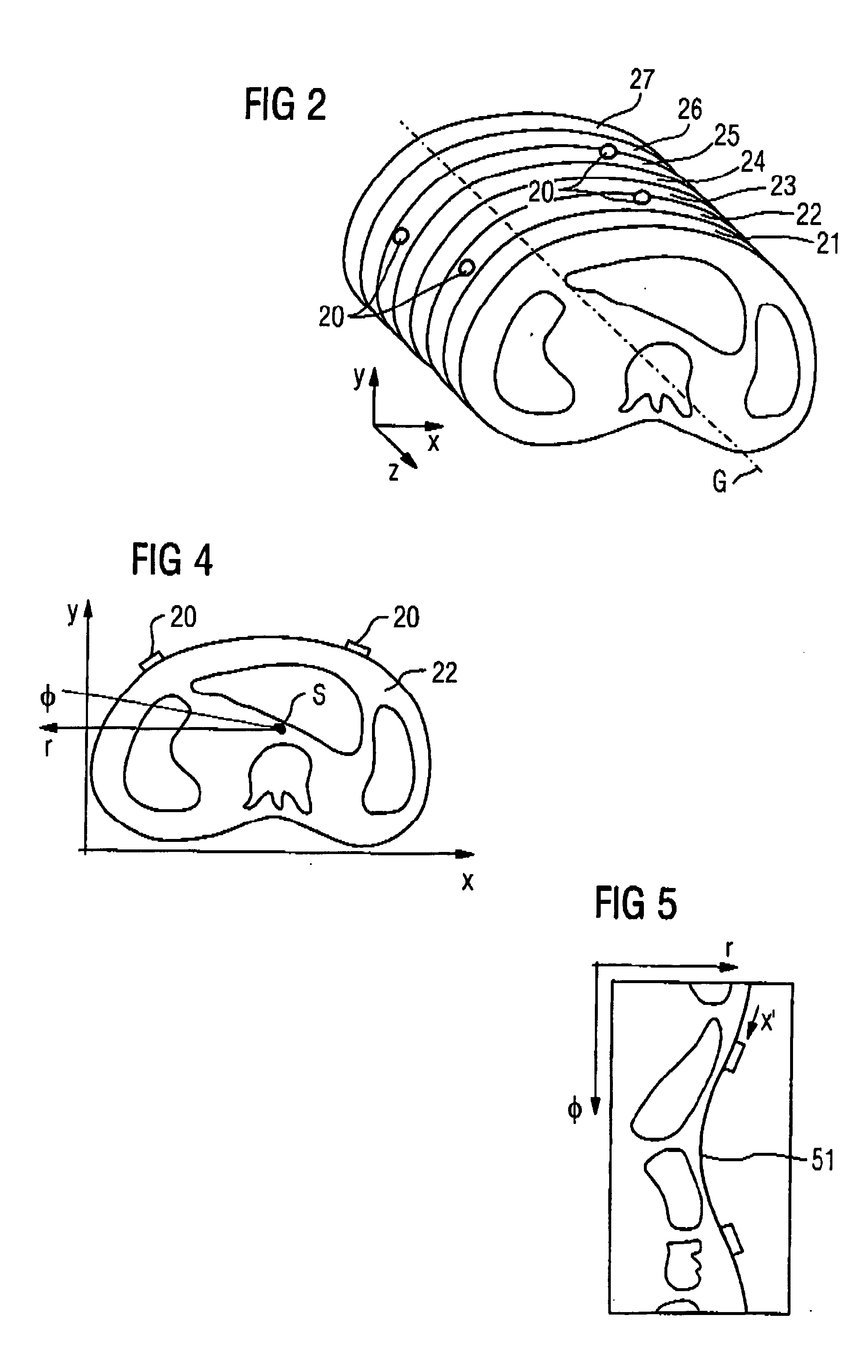 Method and medical device for the automatic determination of coordinates of images of marks in a volume dataset