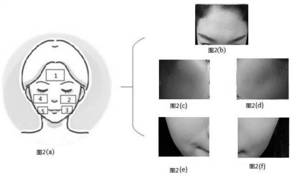 Skin quality detection method and system based on big data algorithm, and equipment