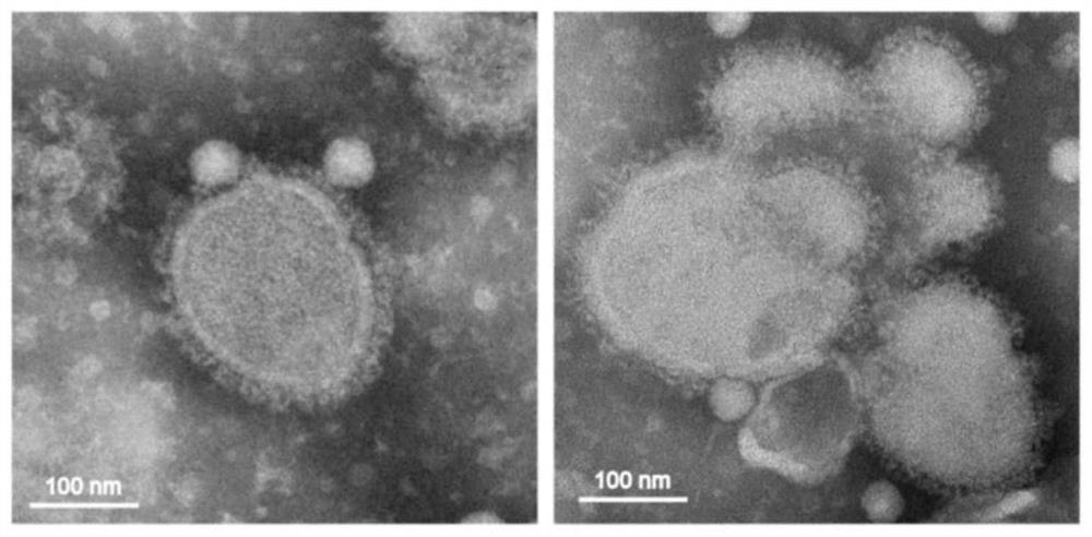 H7N9 subtype avian influenza virus-like particle vaccine preparation as well as preparation and application thereof
