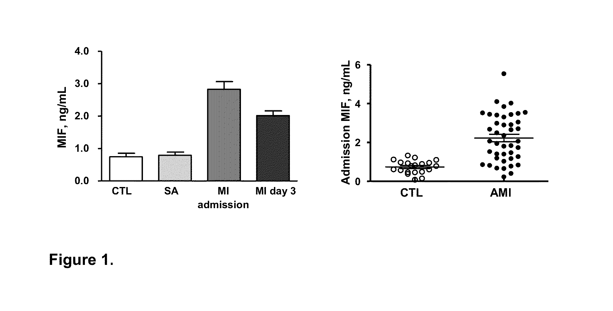 Method for diagnosis, prognosis or treatment of acute coronary syndrome (ACS) comprising measurement of plasma concentration of macrophage migration inhibitory factor (MIF)