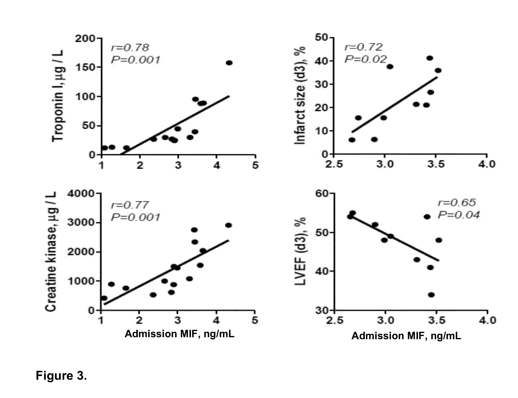 Method for diagnosis, prognosis or treatment of acute coronary syndrome (ACS) comprising measurement of plasma concentration of macrophage migration inhibitory factor (MIF)