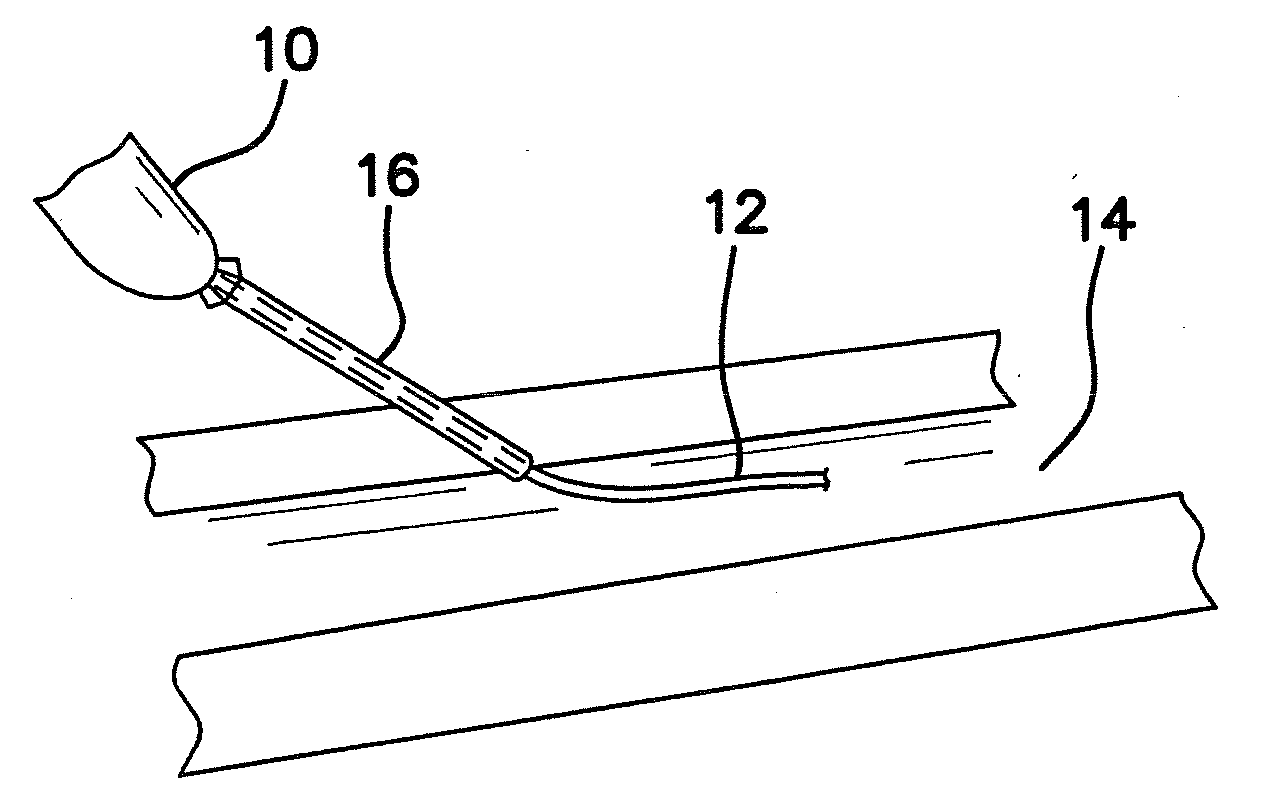Apparatus and method for achieving micropuncture
