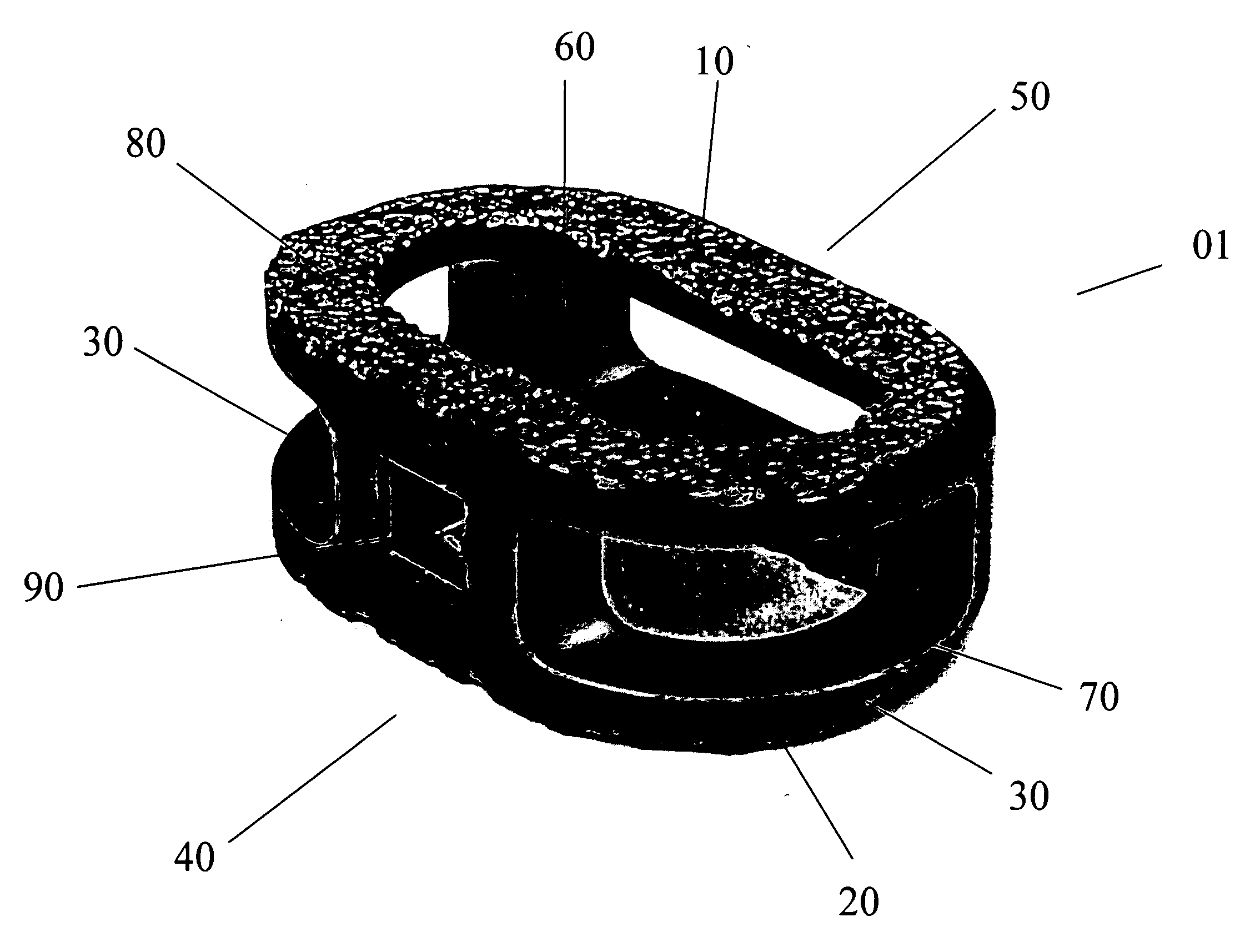 Anterior interbody spinal implant