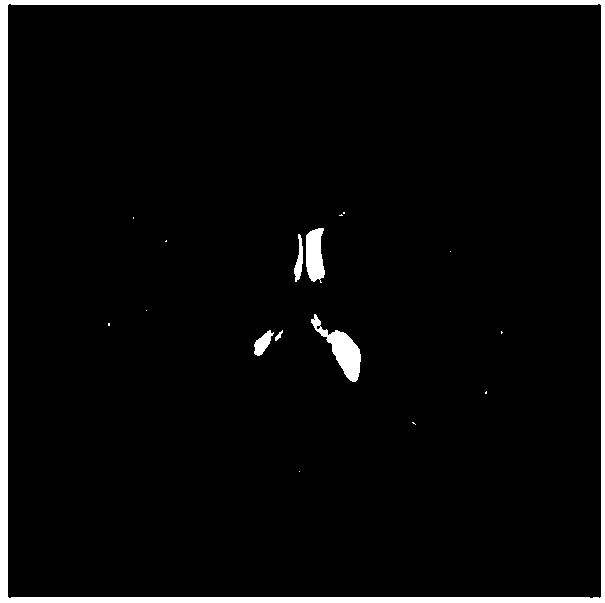 Method based on D-S evidence theory for segmenting brain MRI image